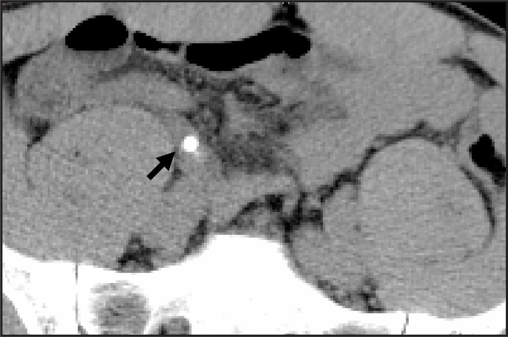 FIGURE 21.