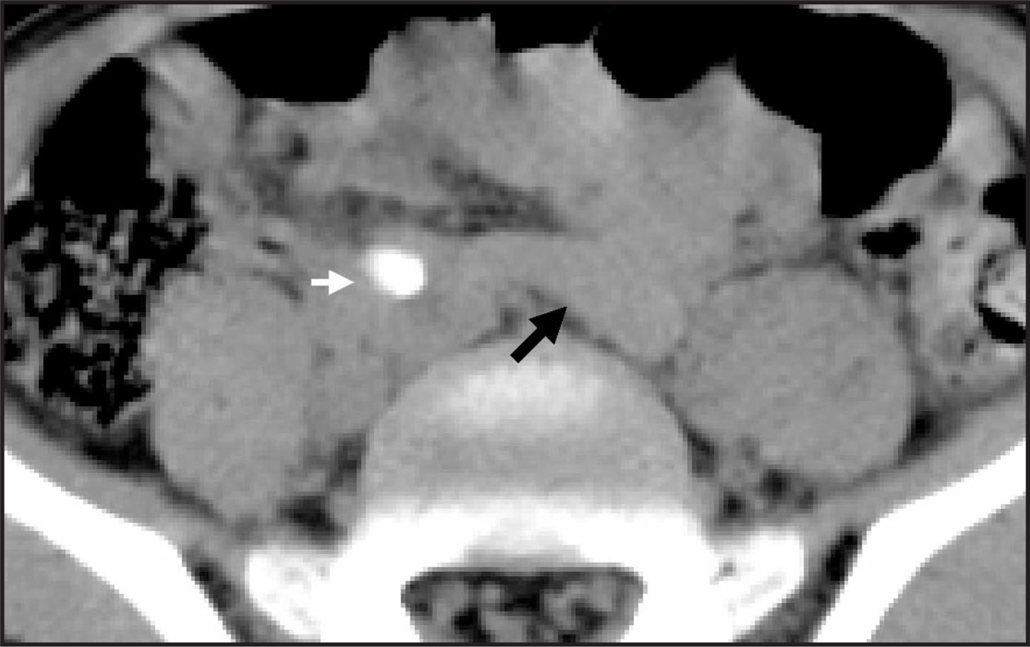 FIGURE 22.