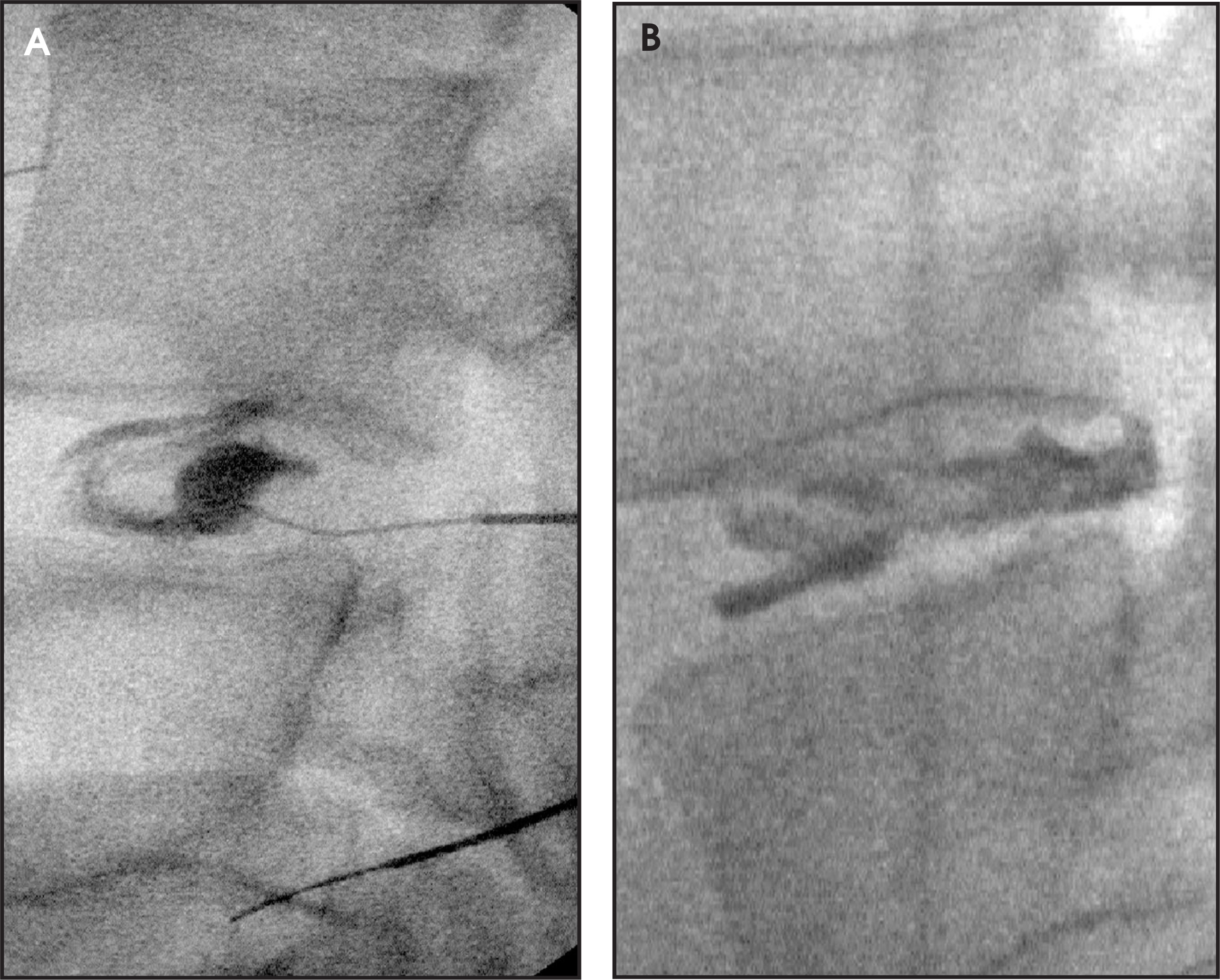 FIGURE 11.