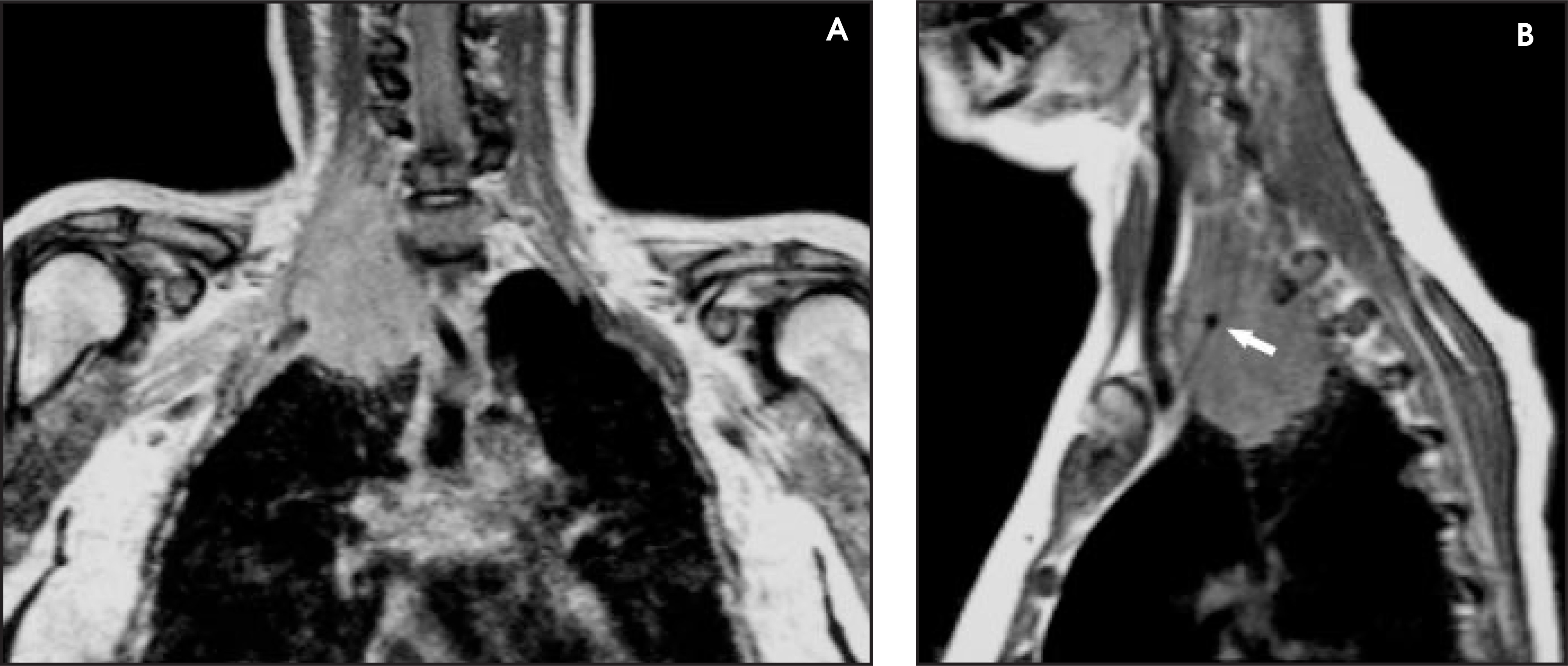 FIGURE 11.