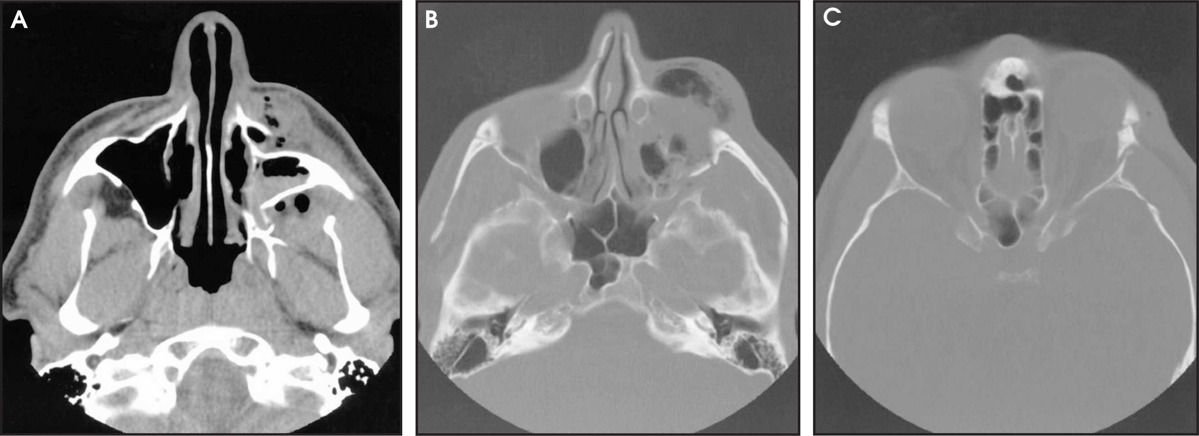 FIGURE 6.