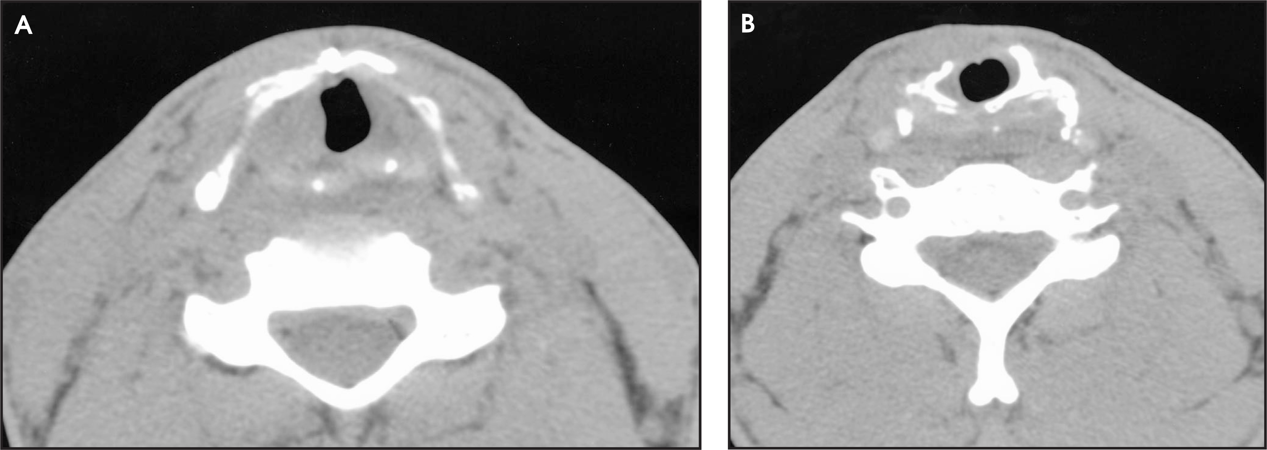 FIGURE 11.