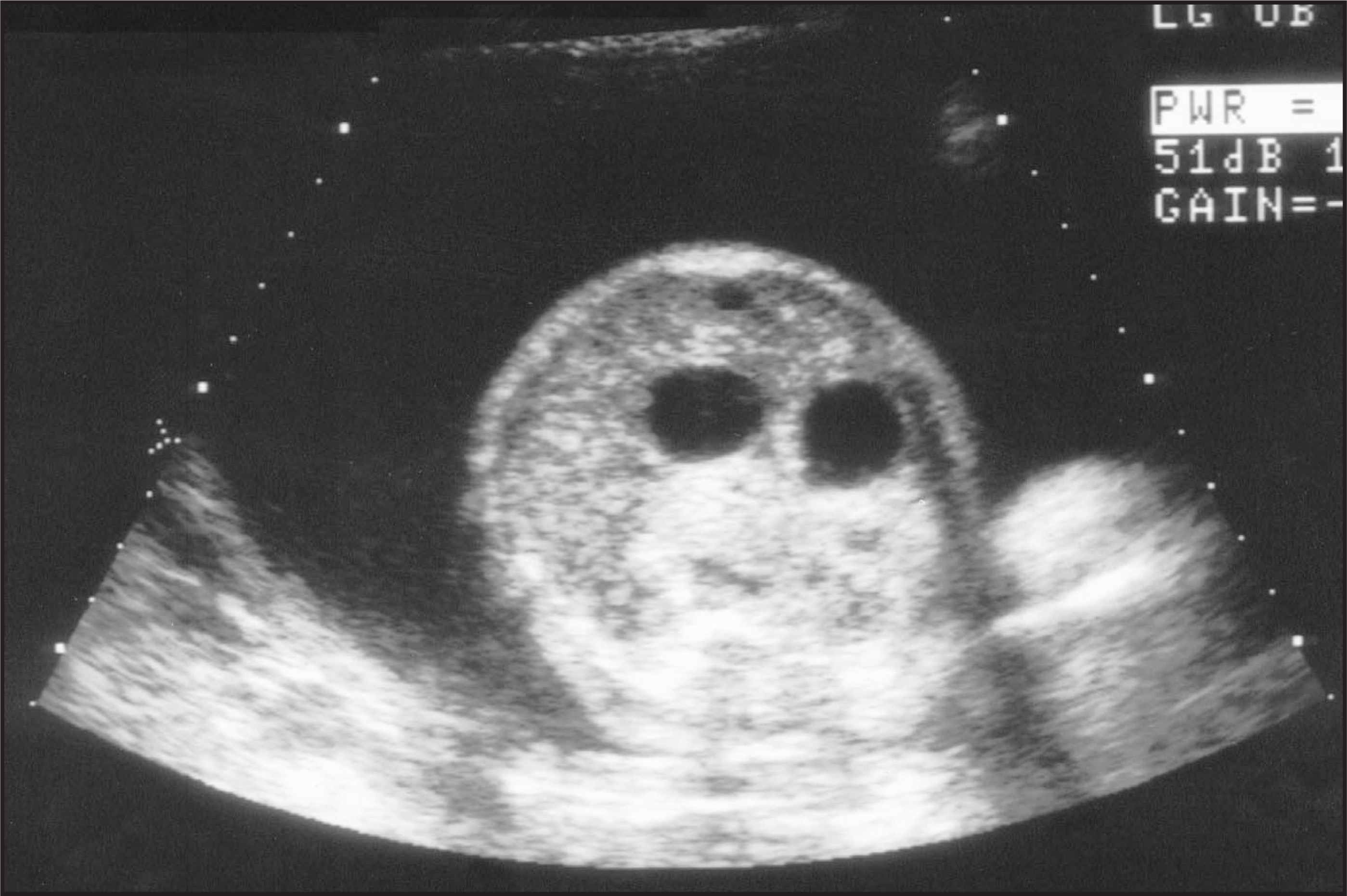 FIGURE 3.