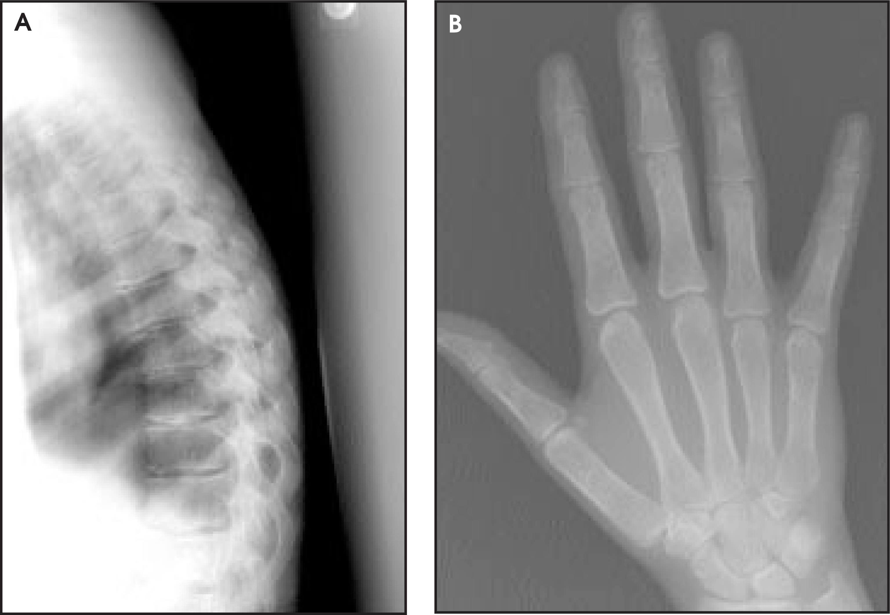 FIGURE 11.