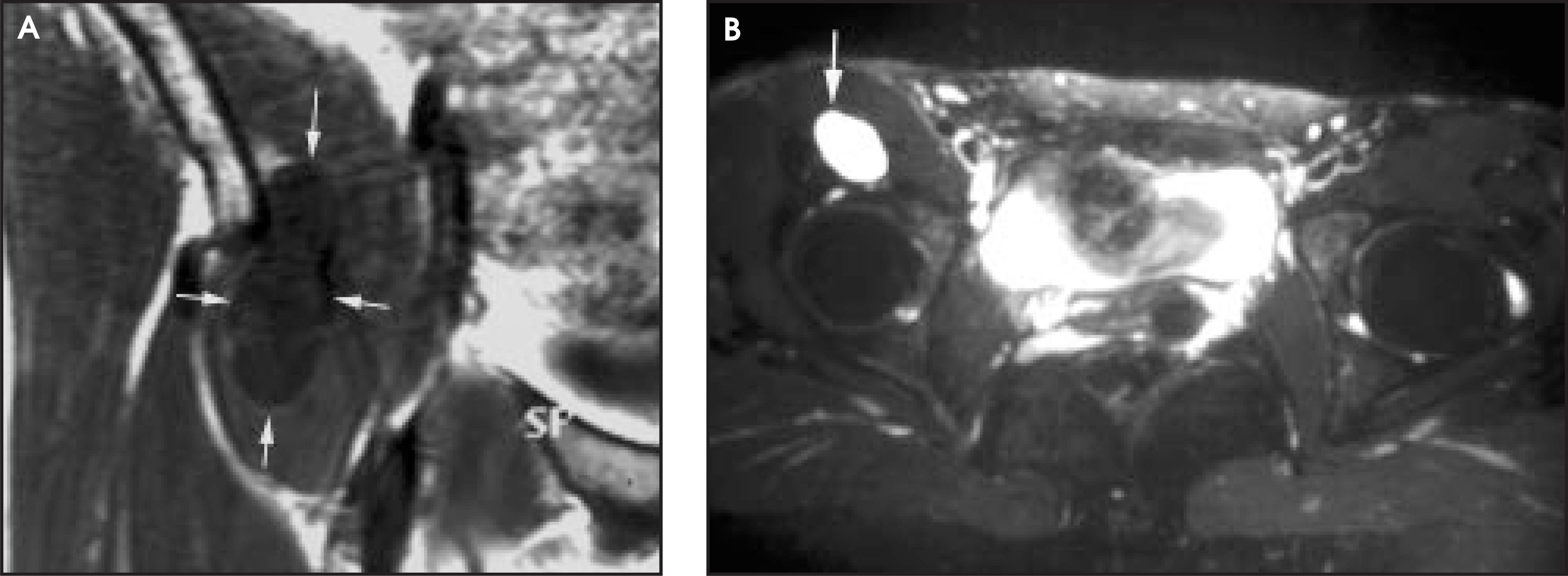 FIGURE 13.