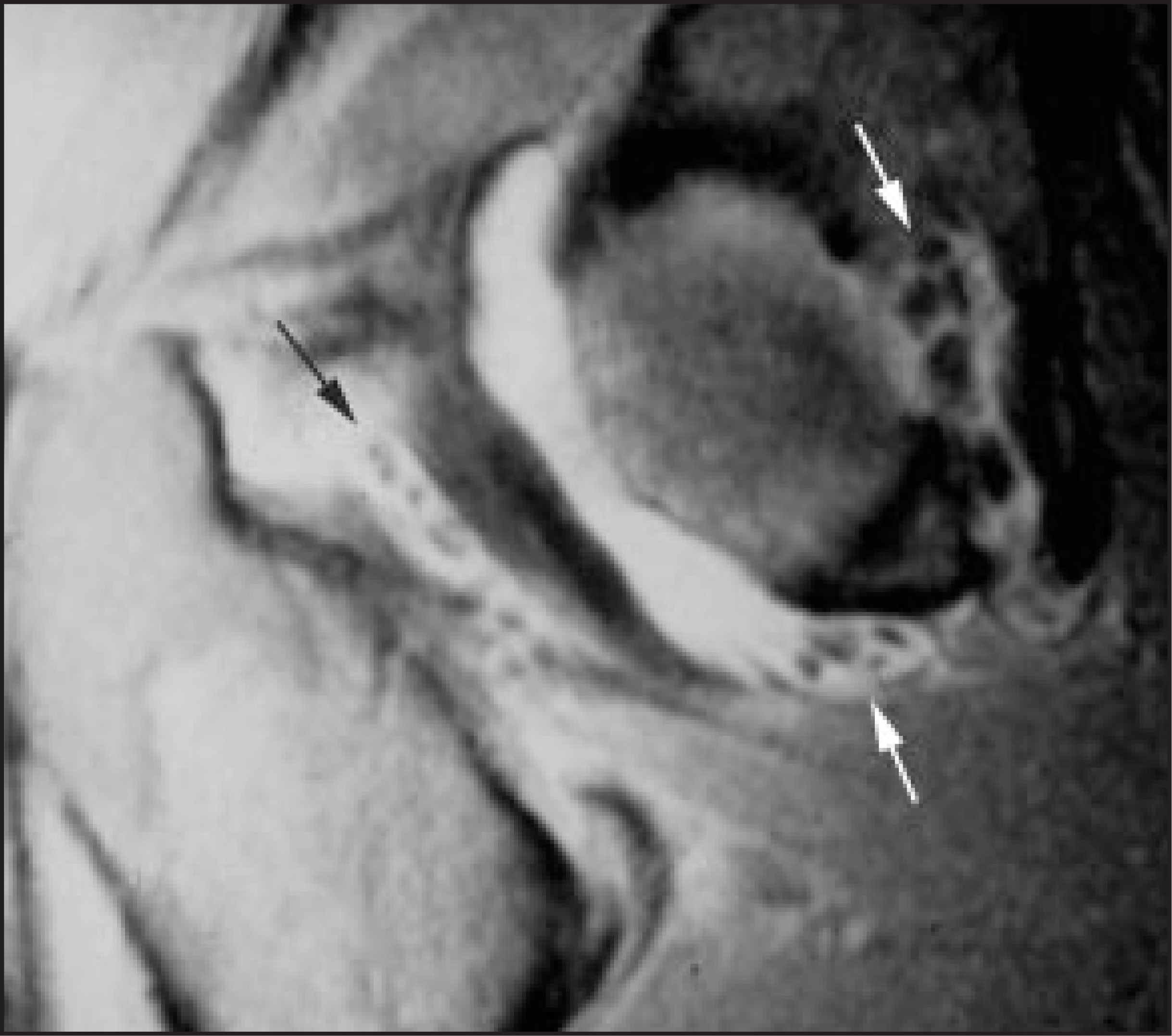 FIGURE 14.