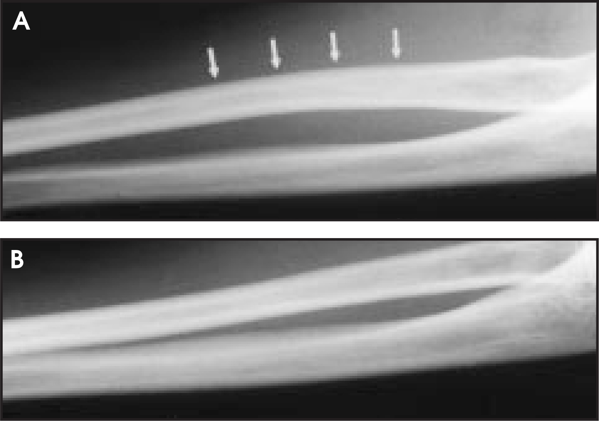 FIGURE 11.