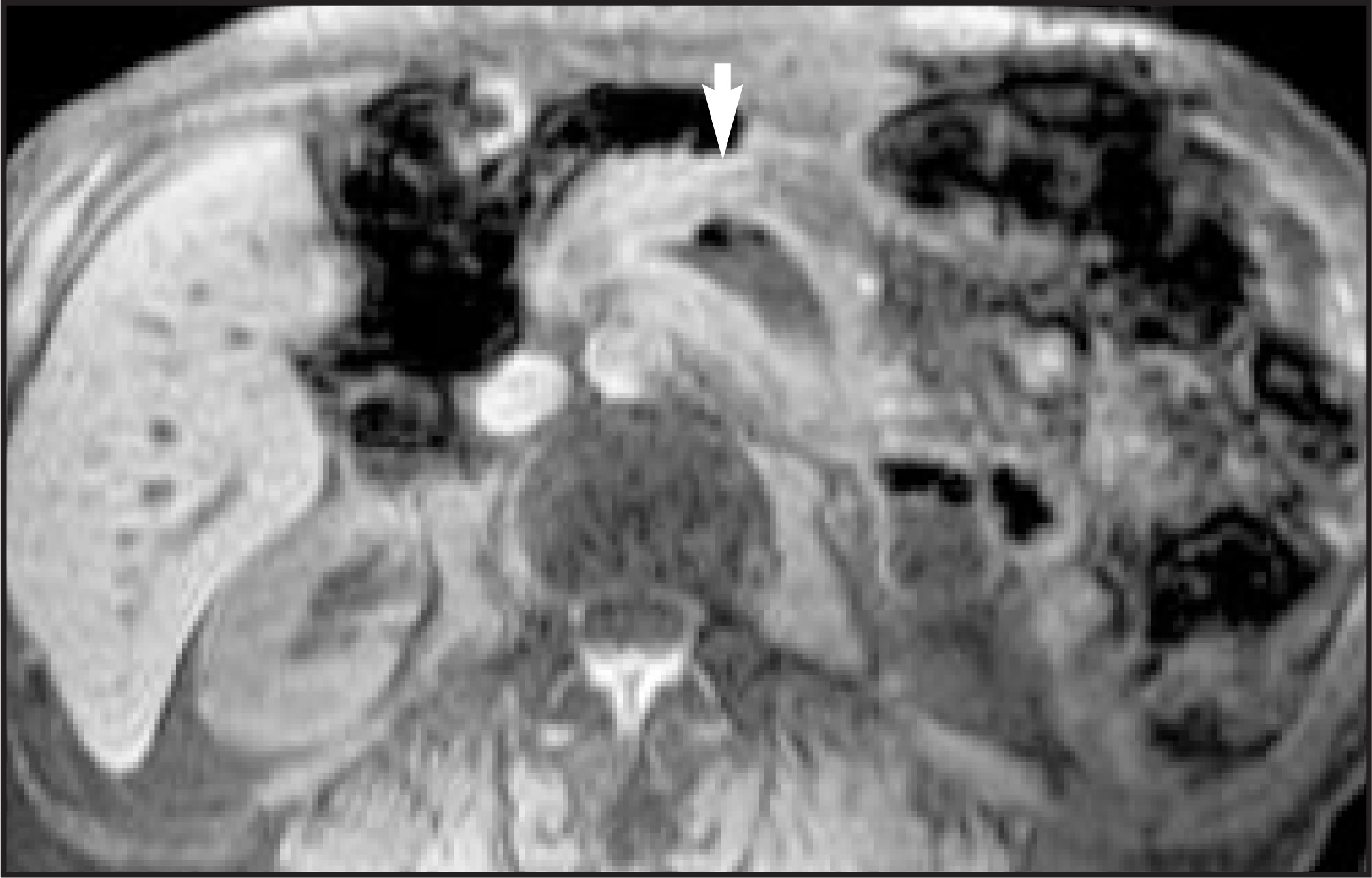 FIGURE 11.