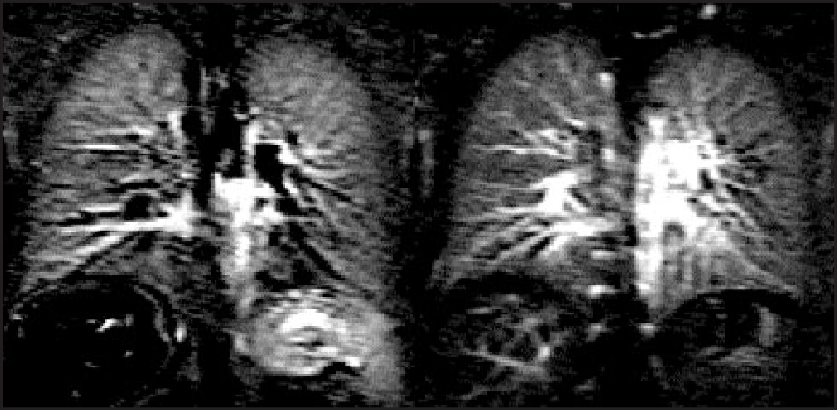 FIGURE 11.
