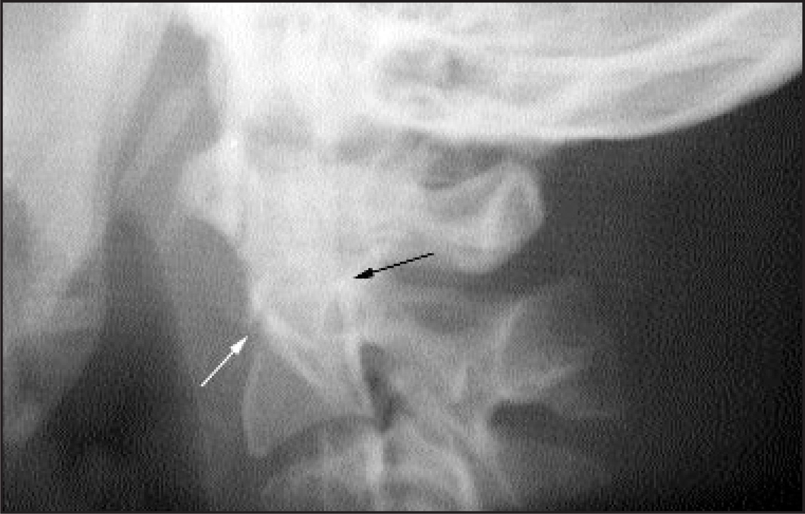 FIGURE 11.