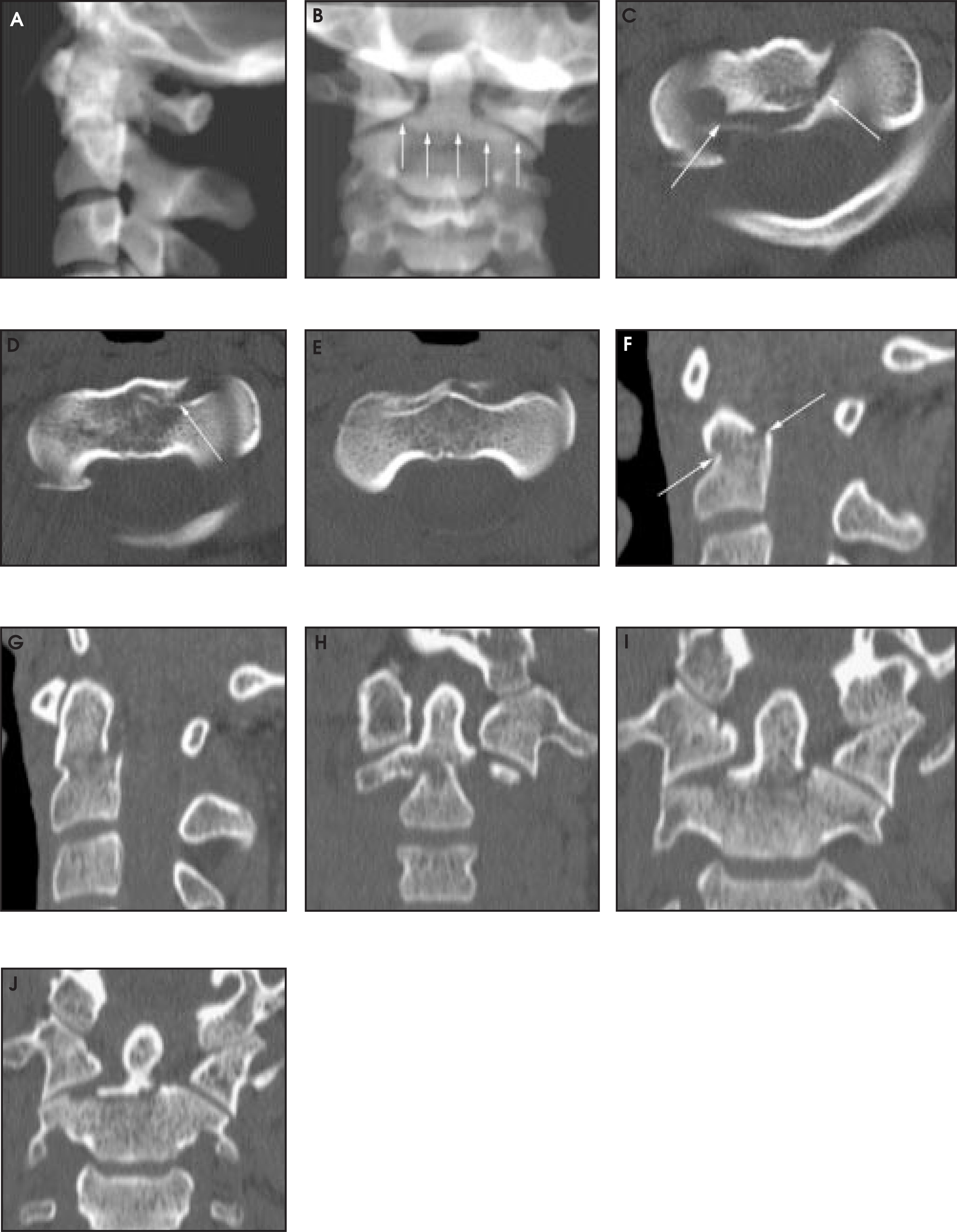 FIGURE 13.