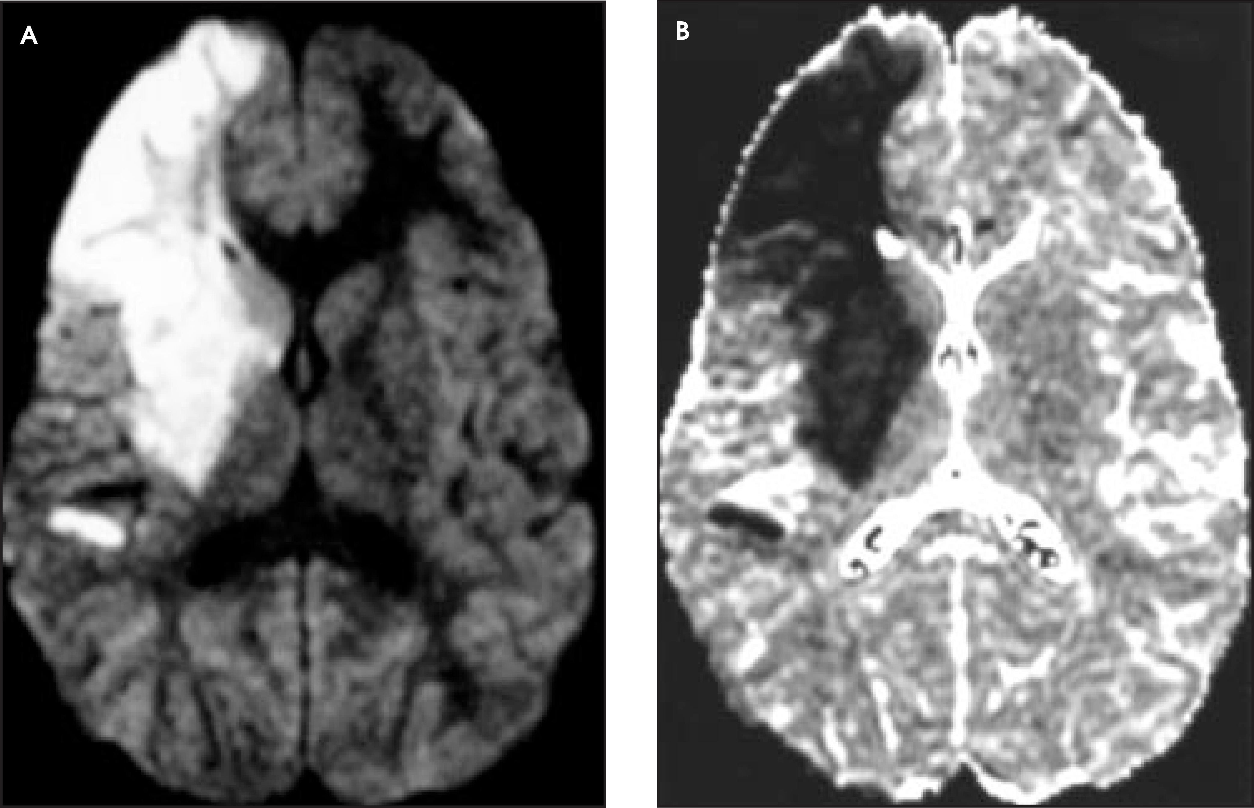 FIGURE 3.