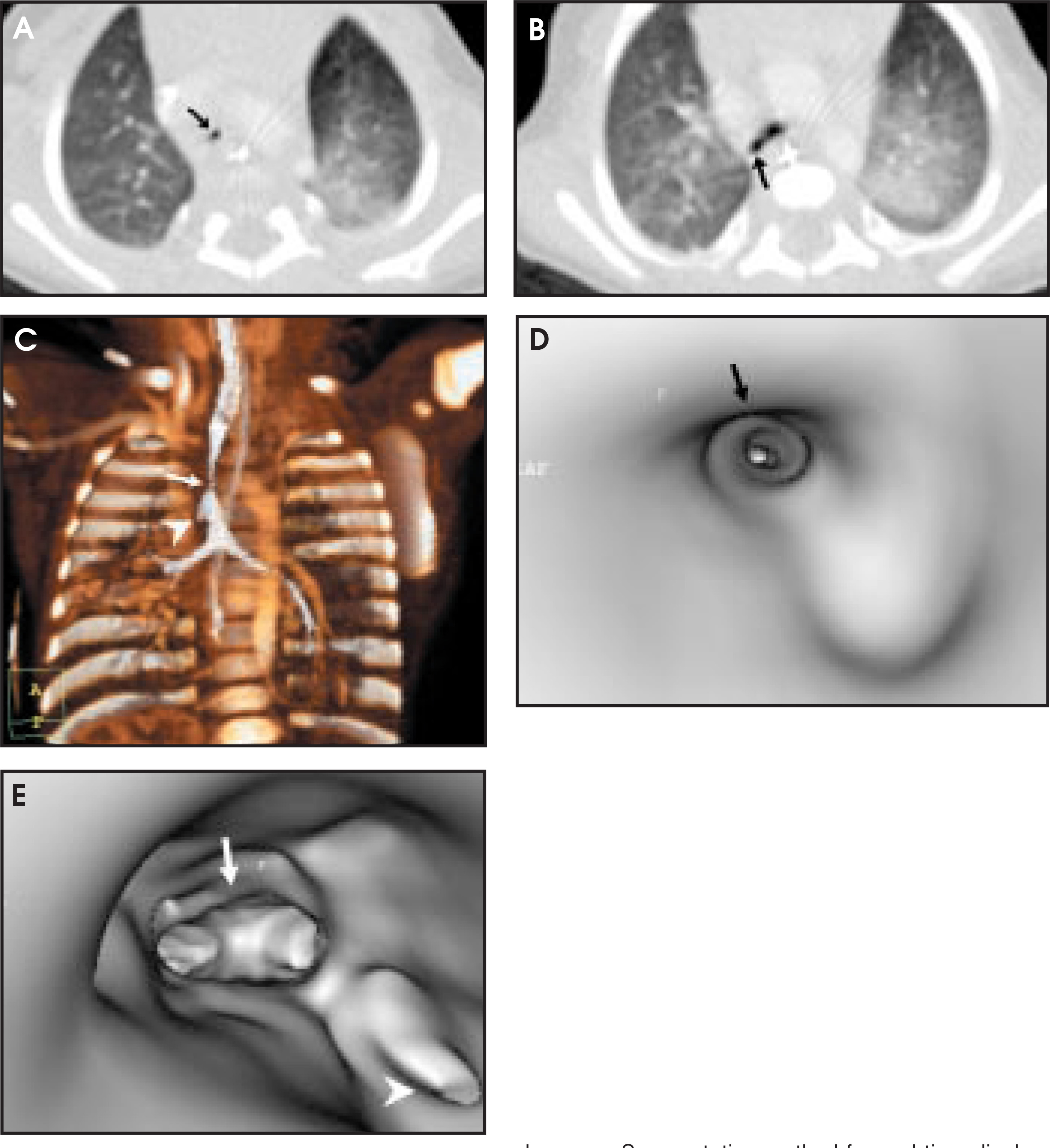 FIGURE 11.