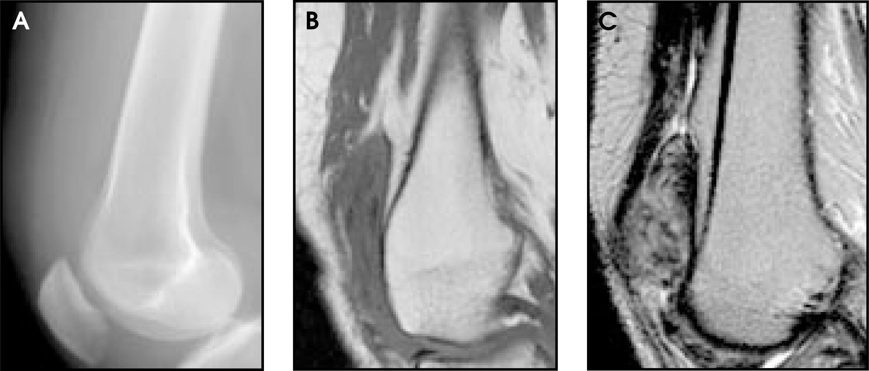 FIGURE 11.