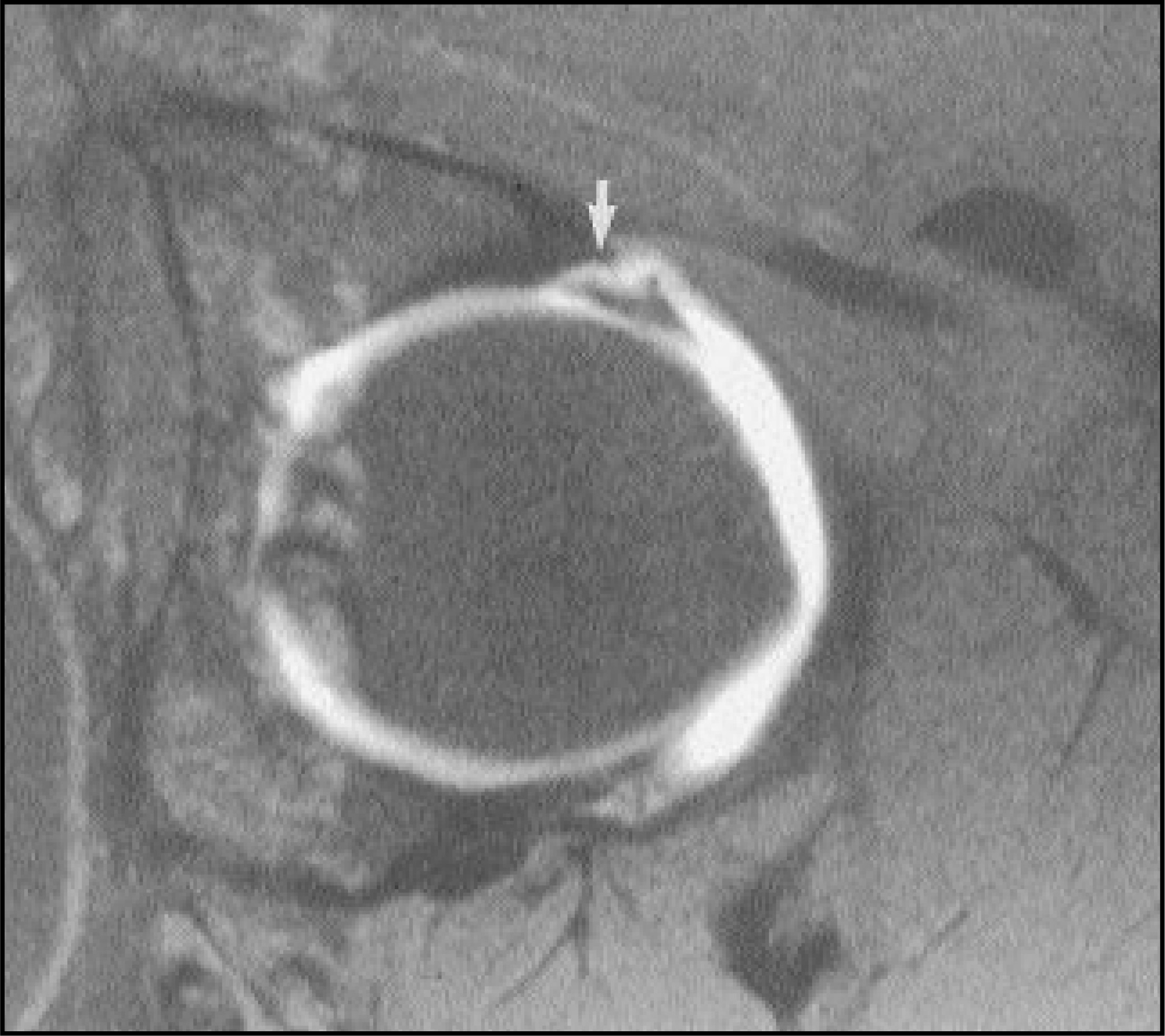 FIGURE 11.
