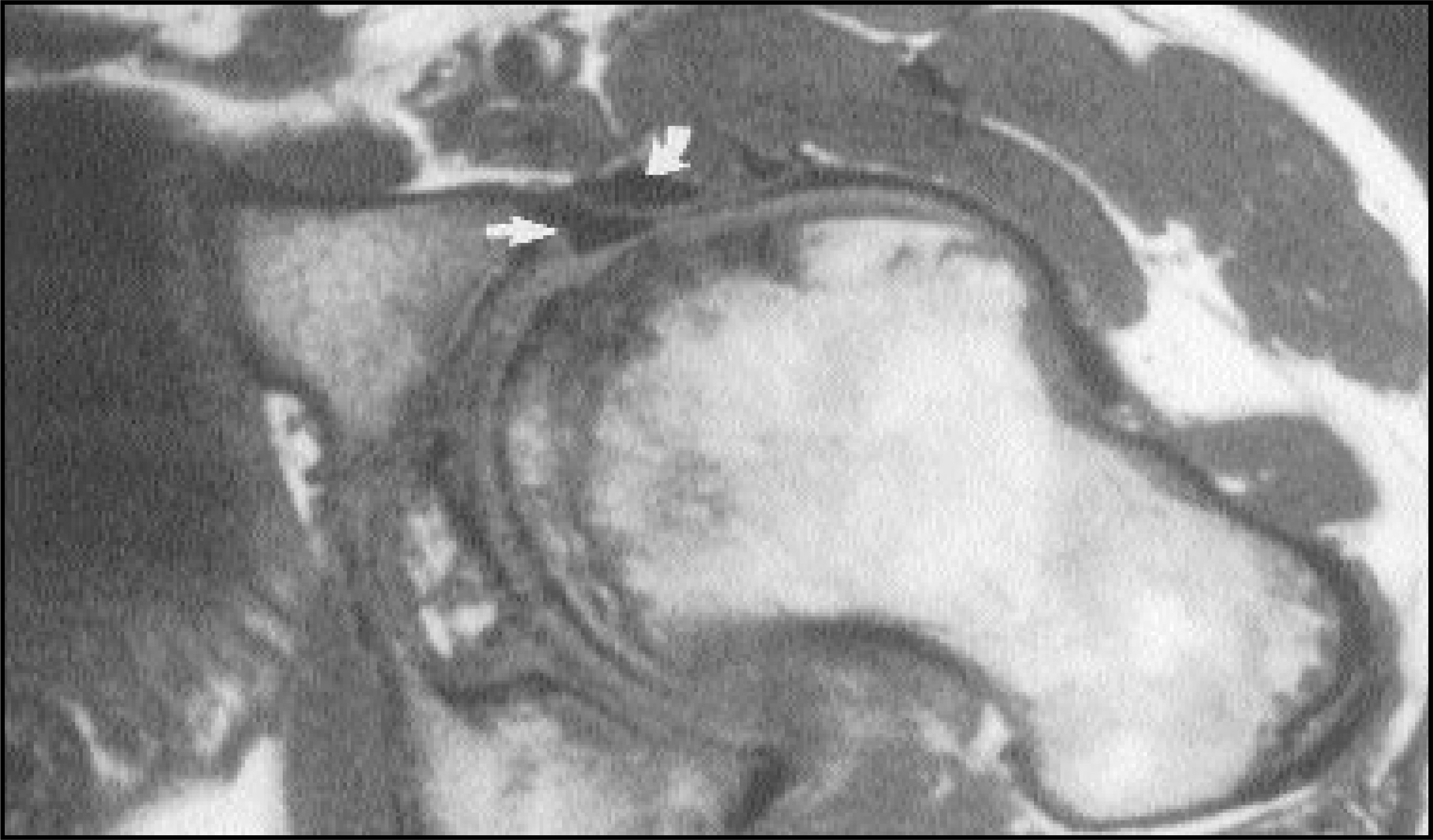 FIGURE 14.