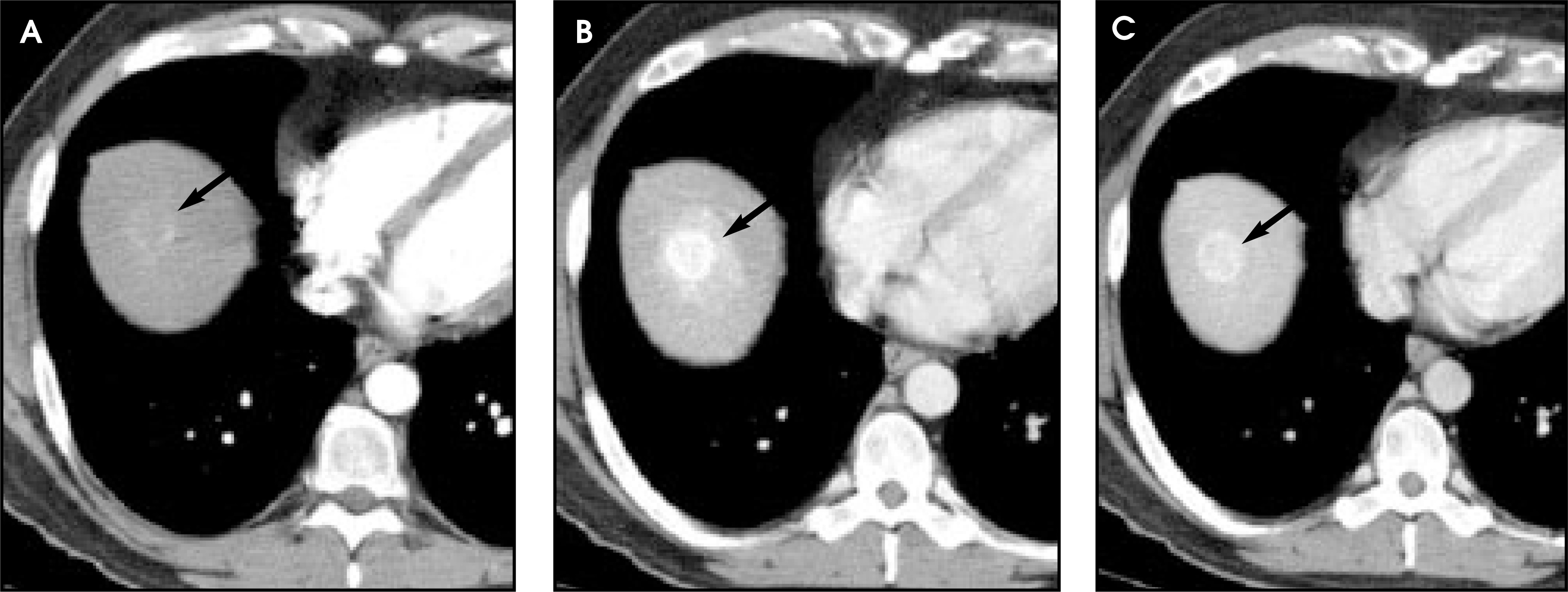 FIGURE 11.