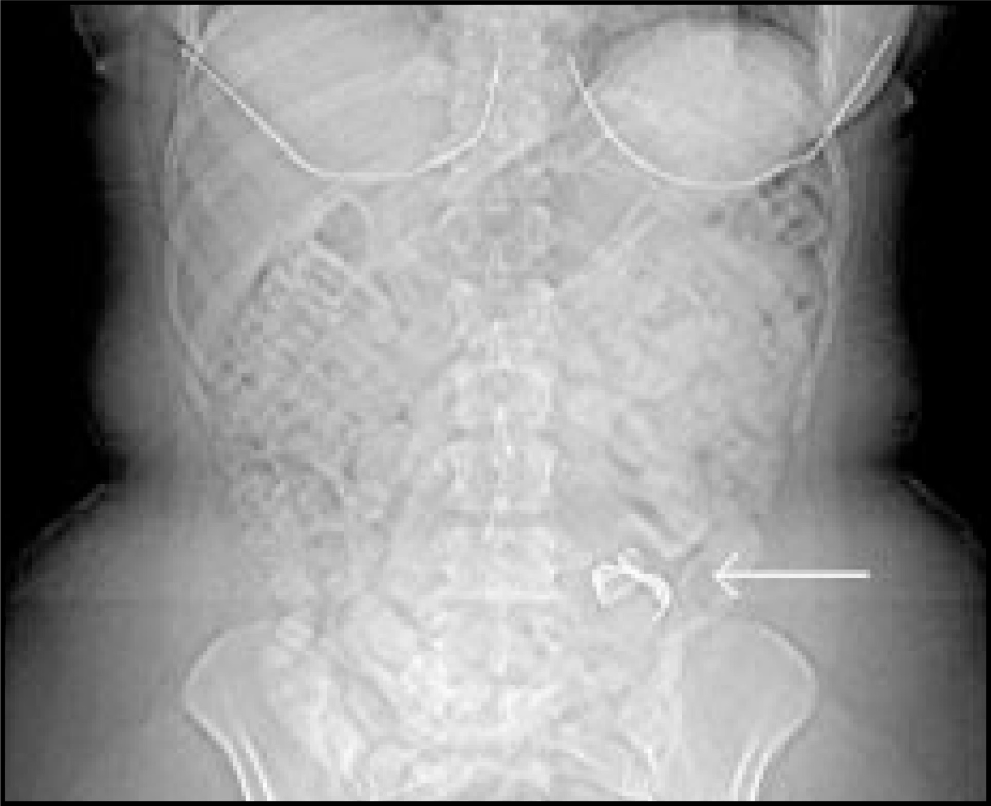 FIGURE 3.