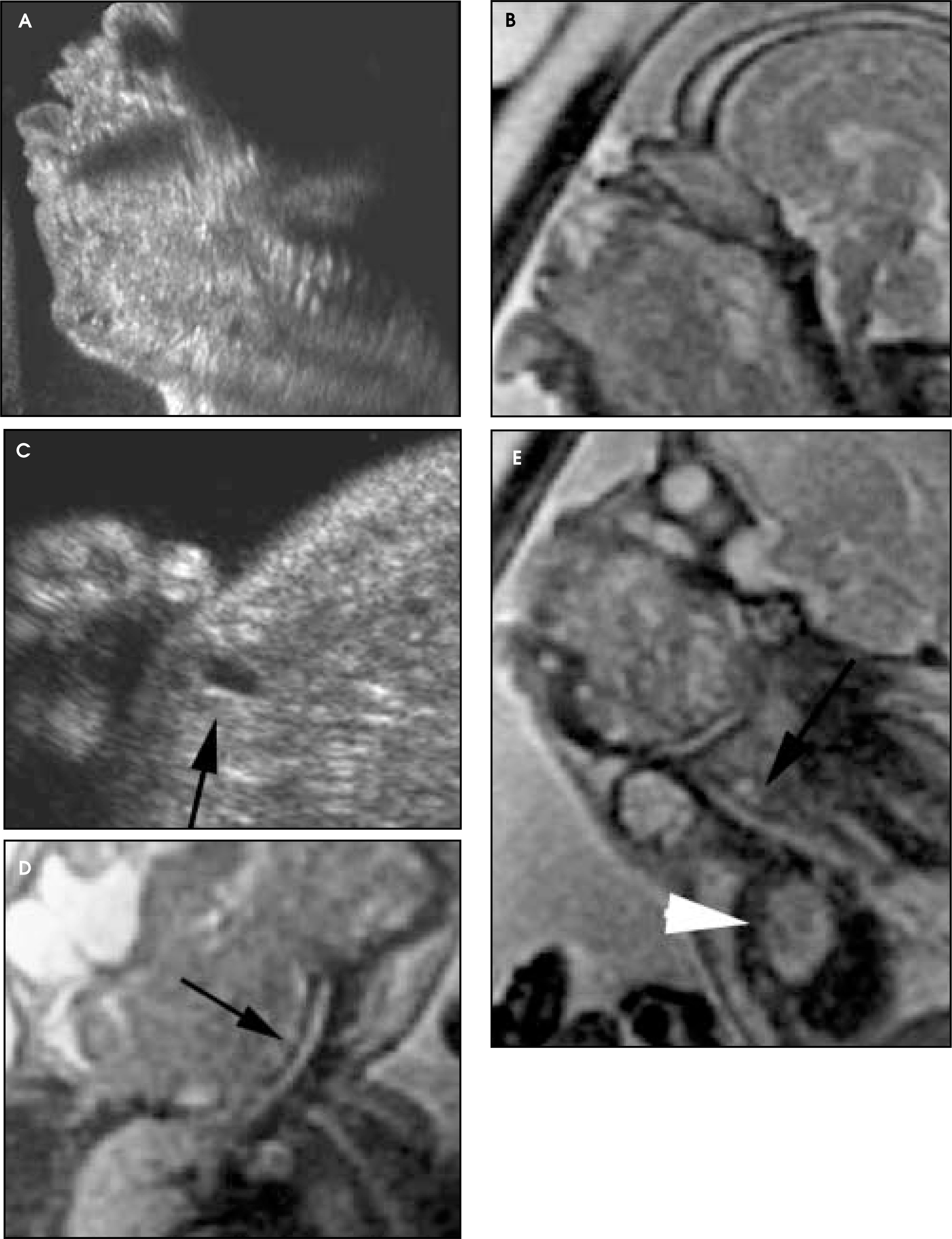 FIGURE 11.