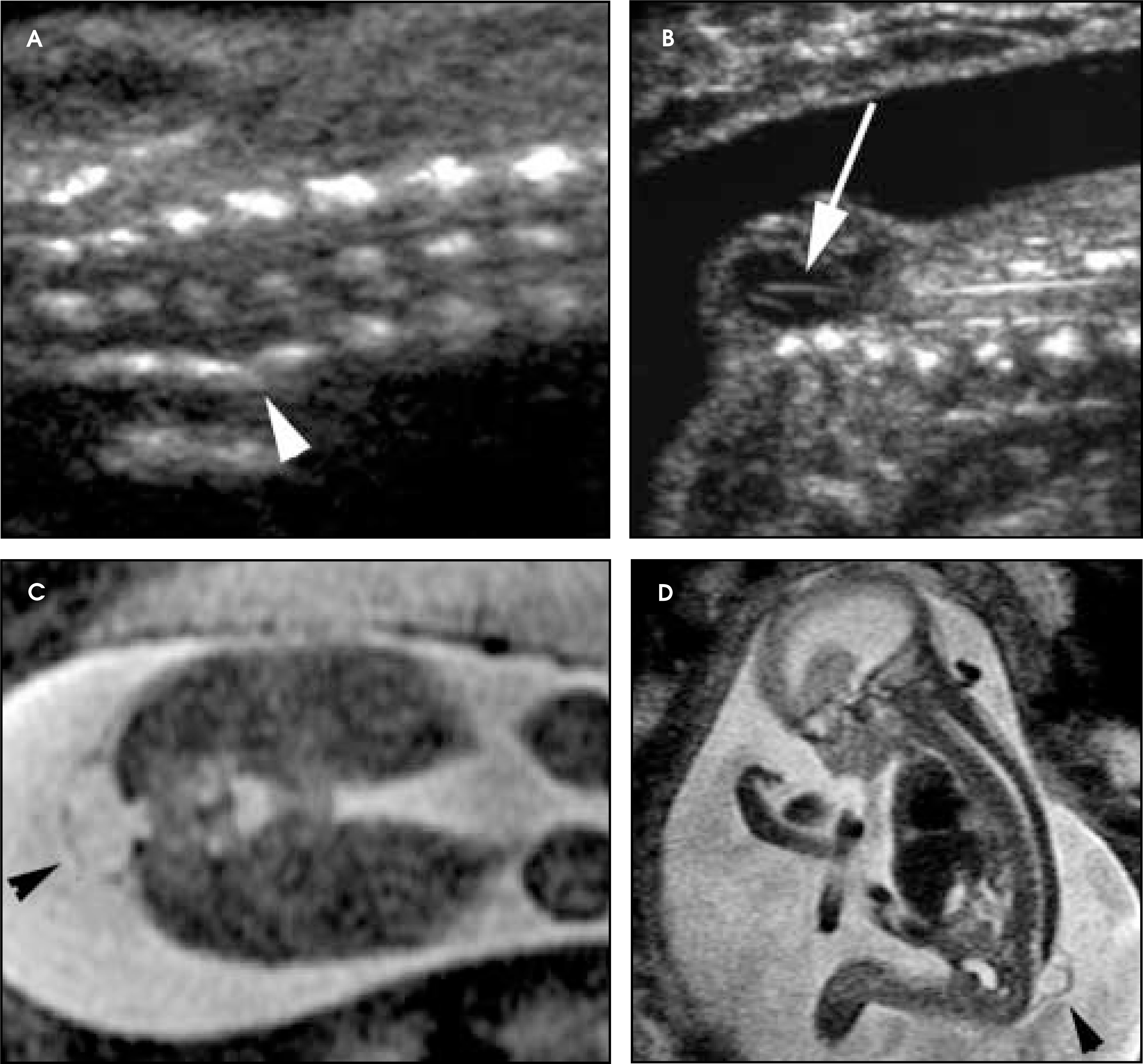 FIGURE 13.