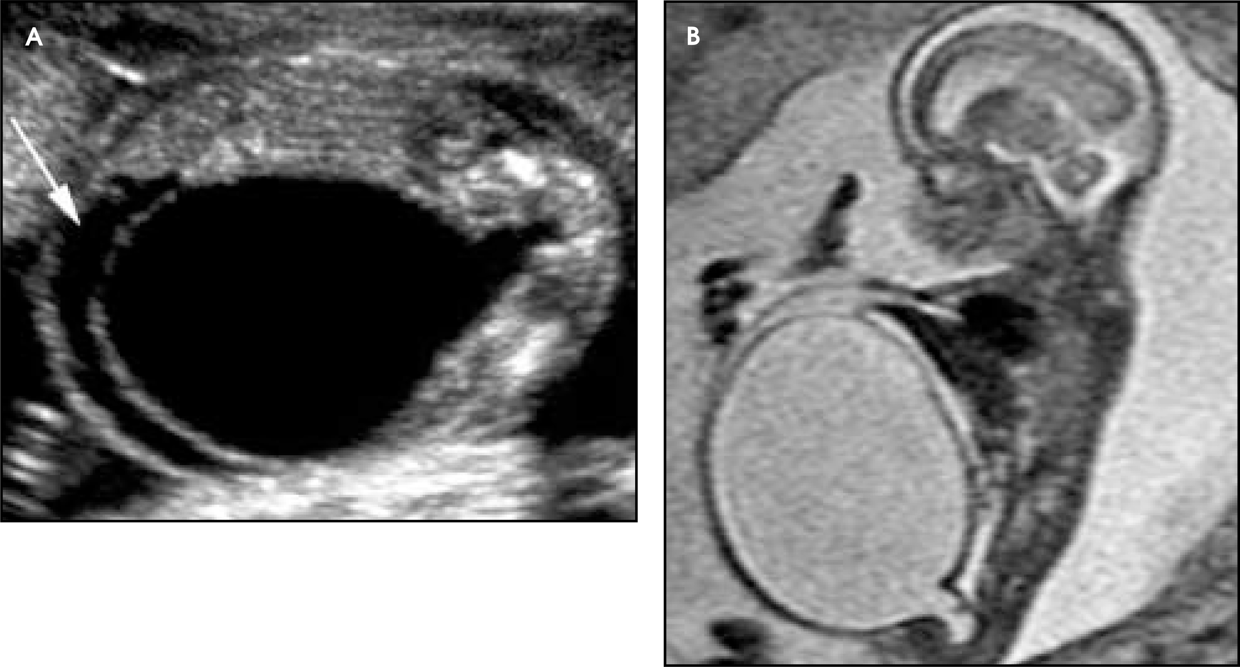 FIGURE 18.