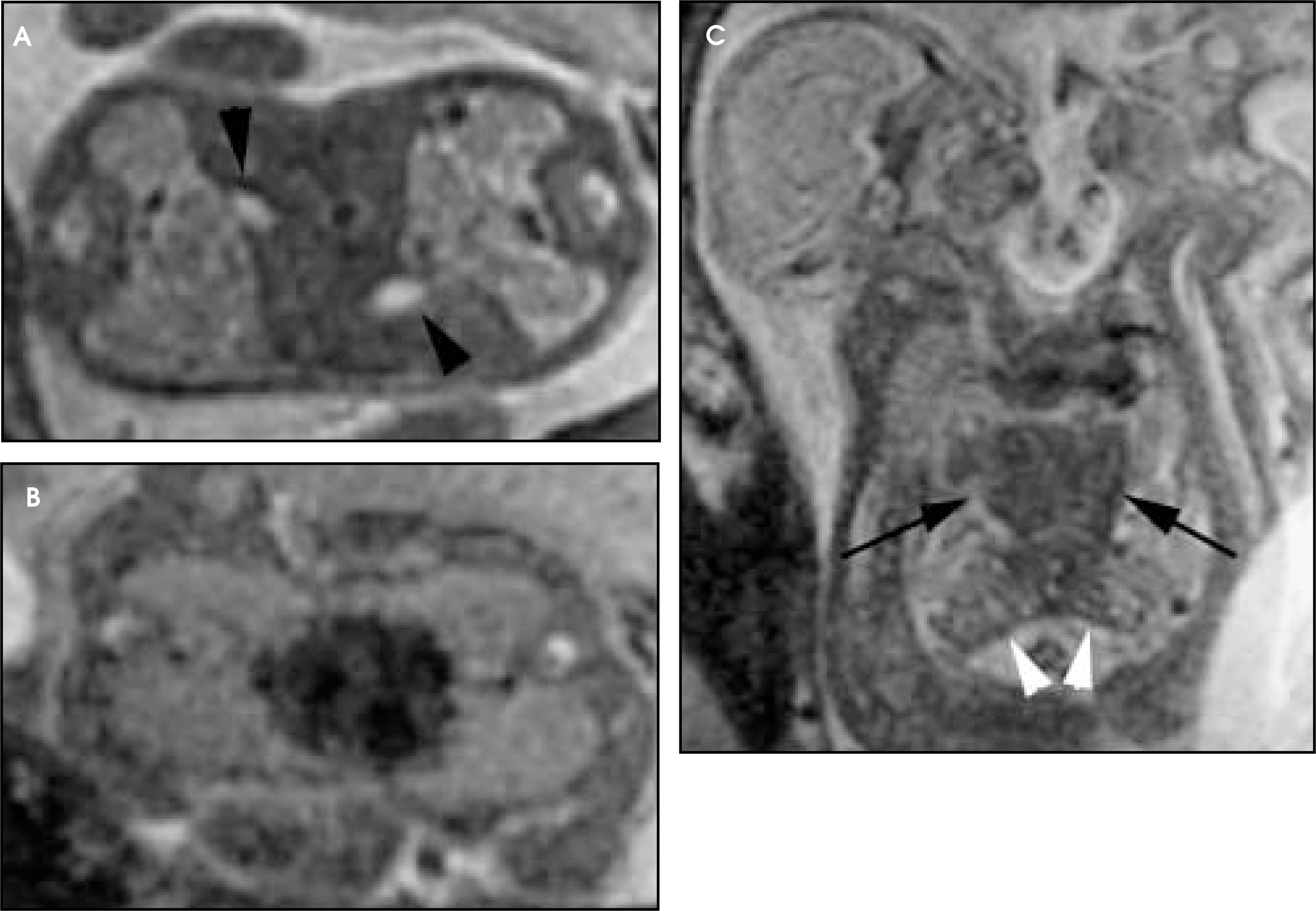 FIGURE 21.