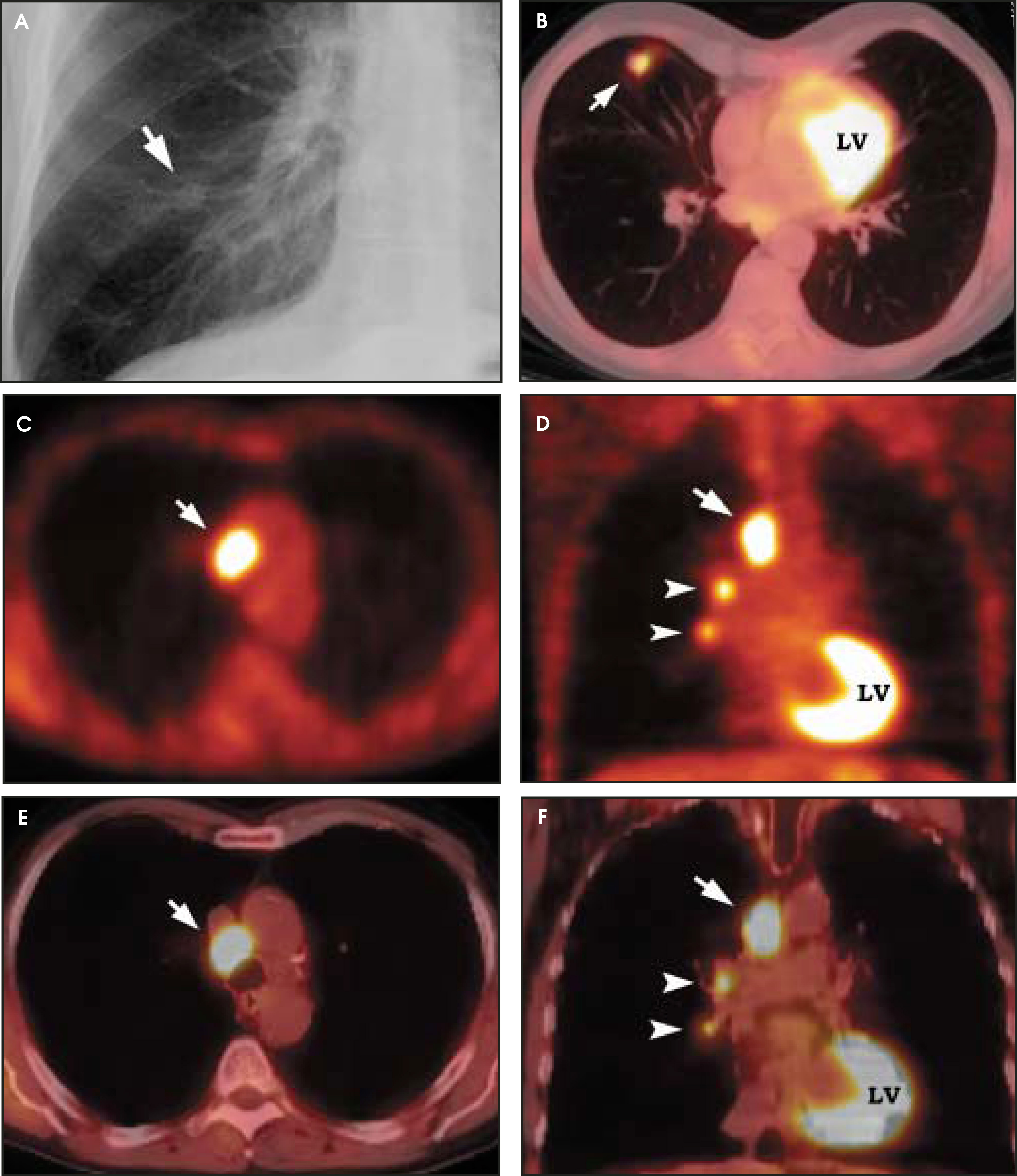 FIGURE 12.