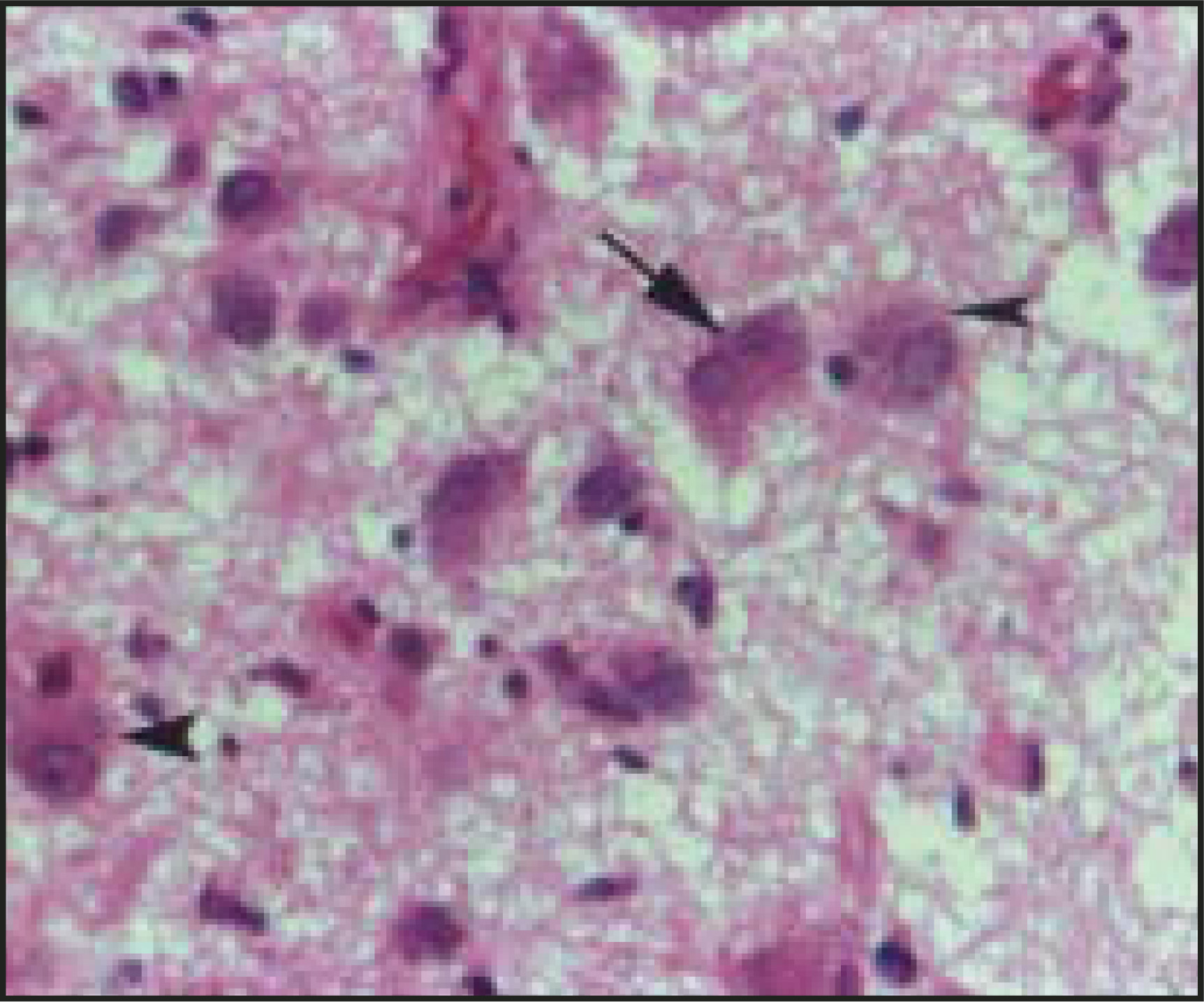 FIGURE 3.