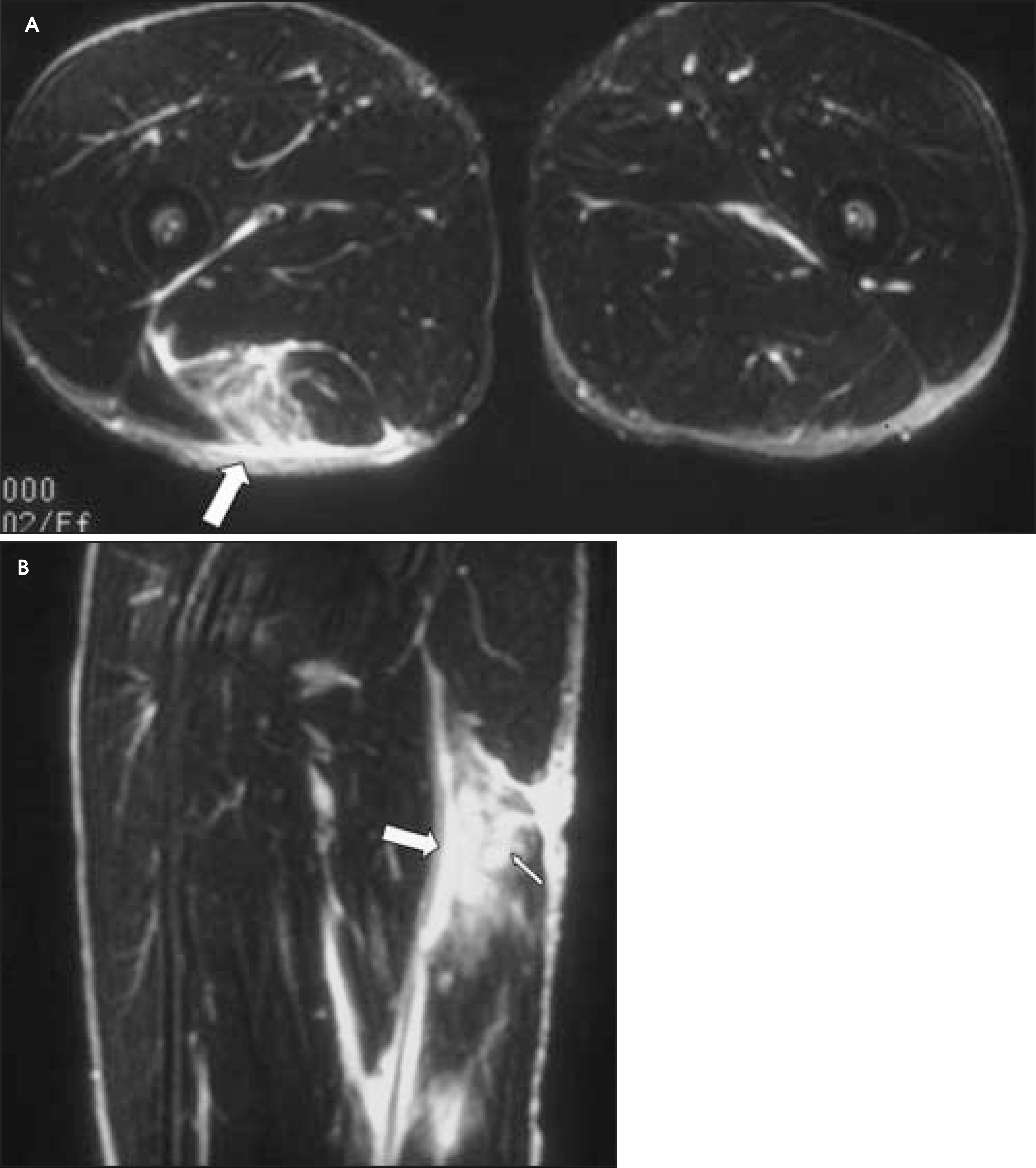 FIGURE 4.