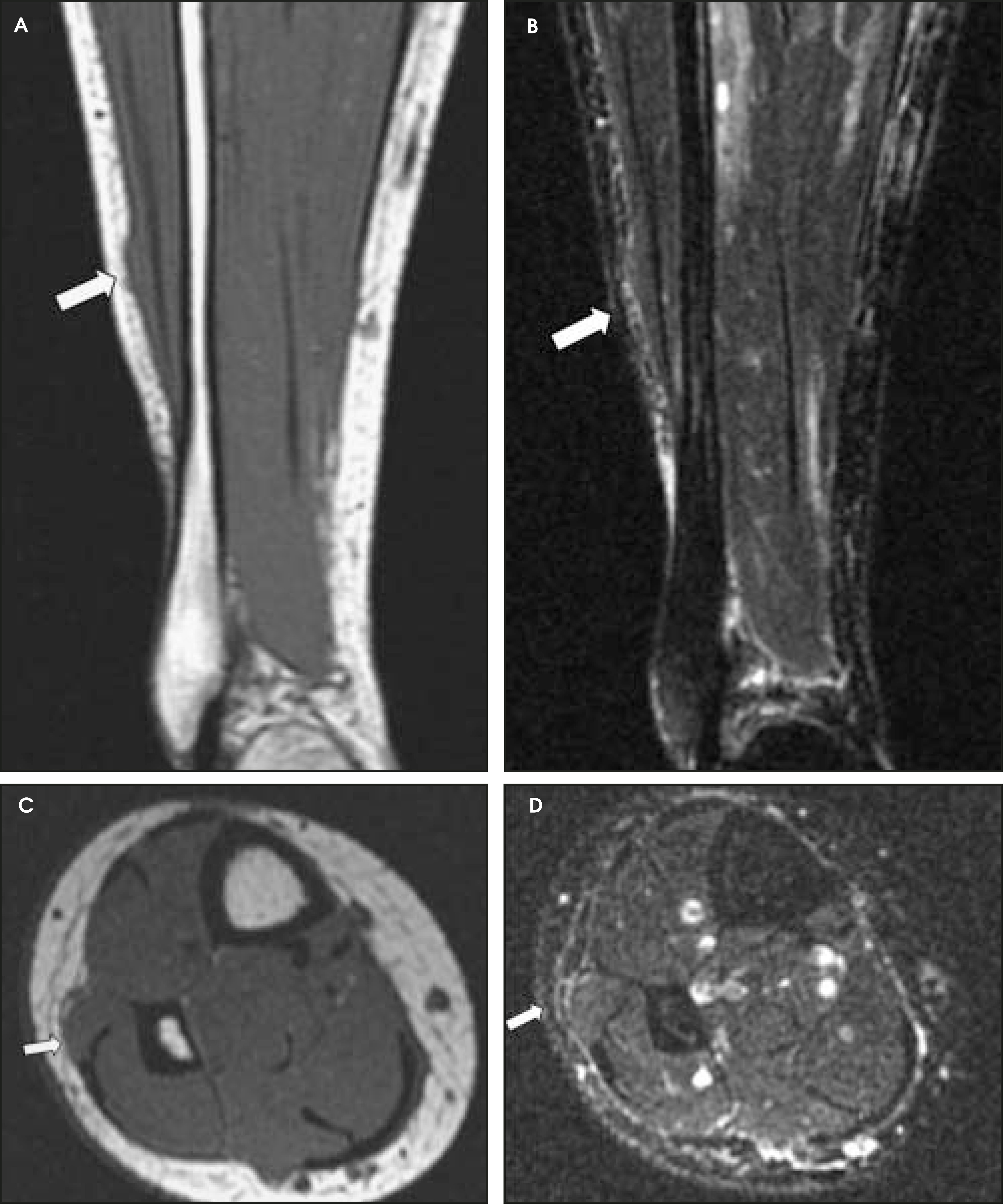 FIGURE 11.