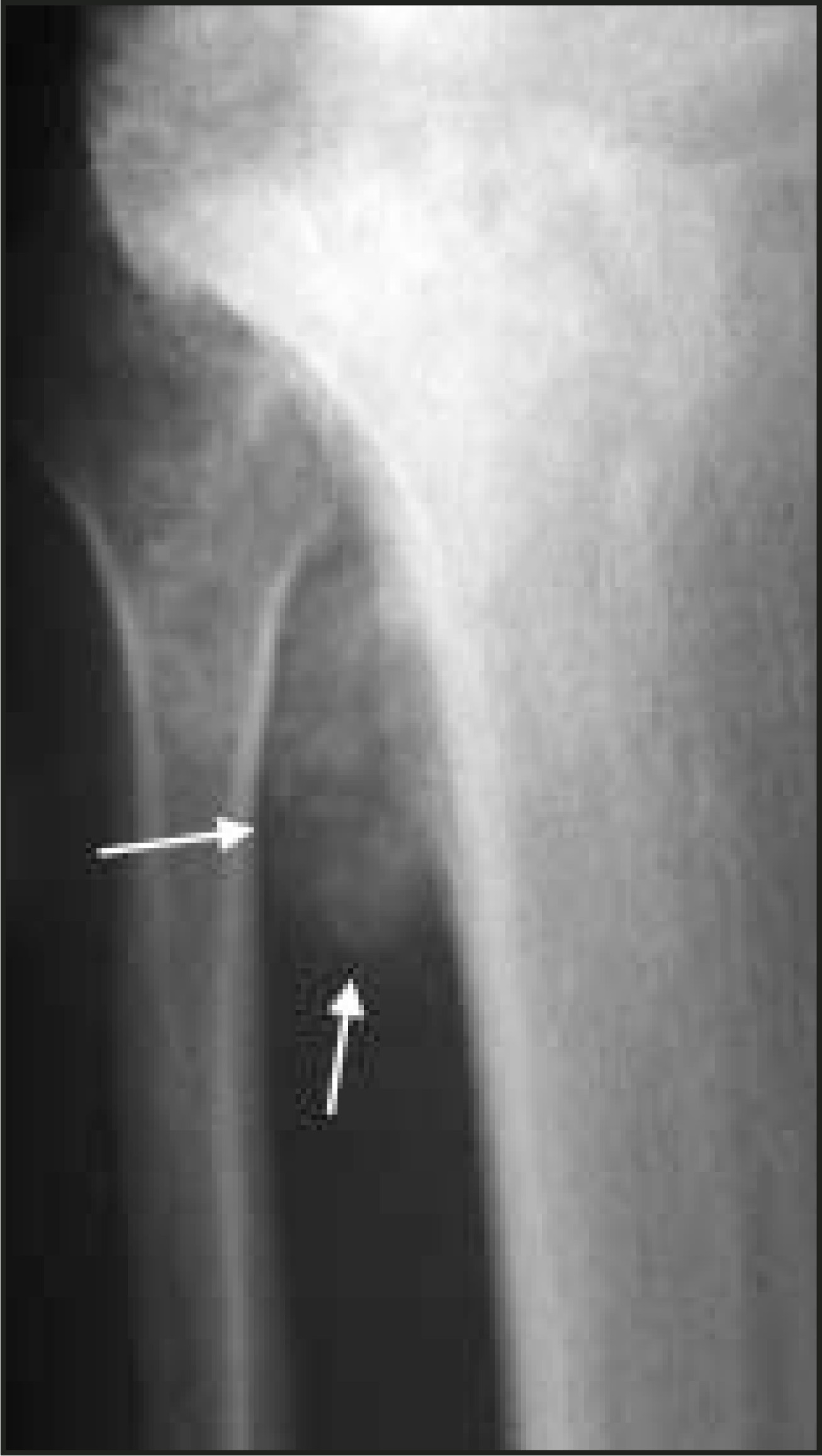 FIGURE 11.
