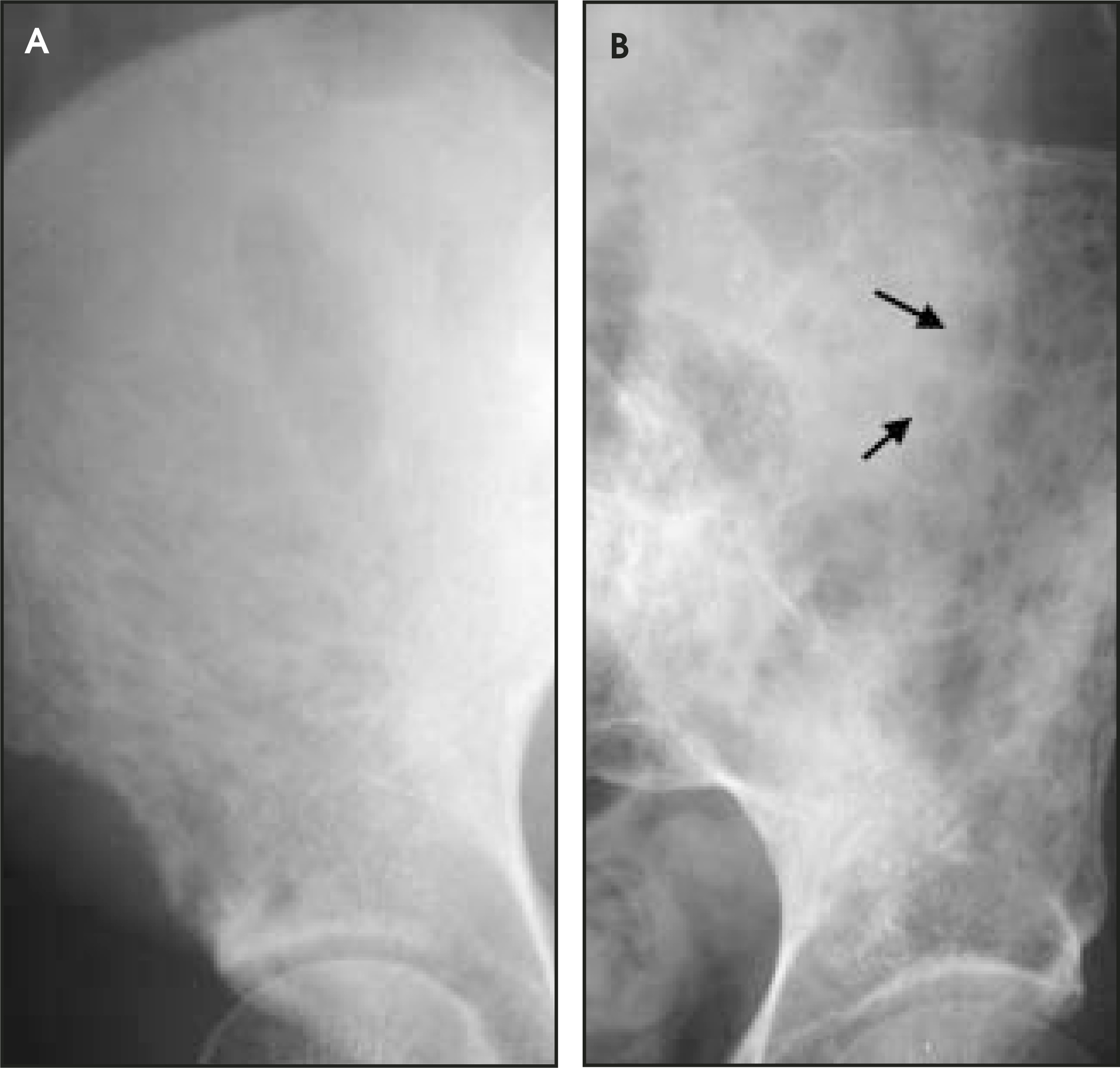 FIGURE 13.