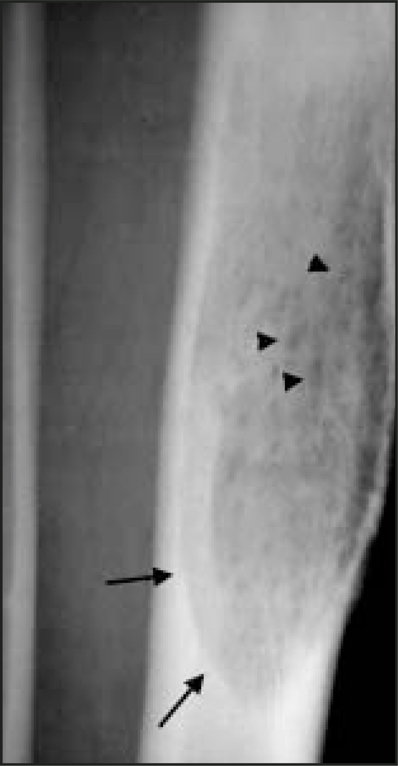 FIGURE 14.
