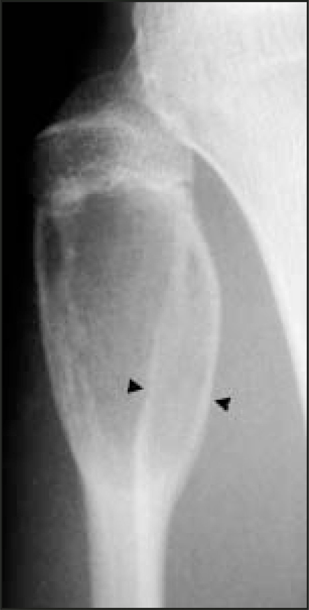 FIGURE 16.