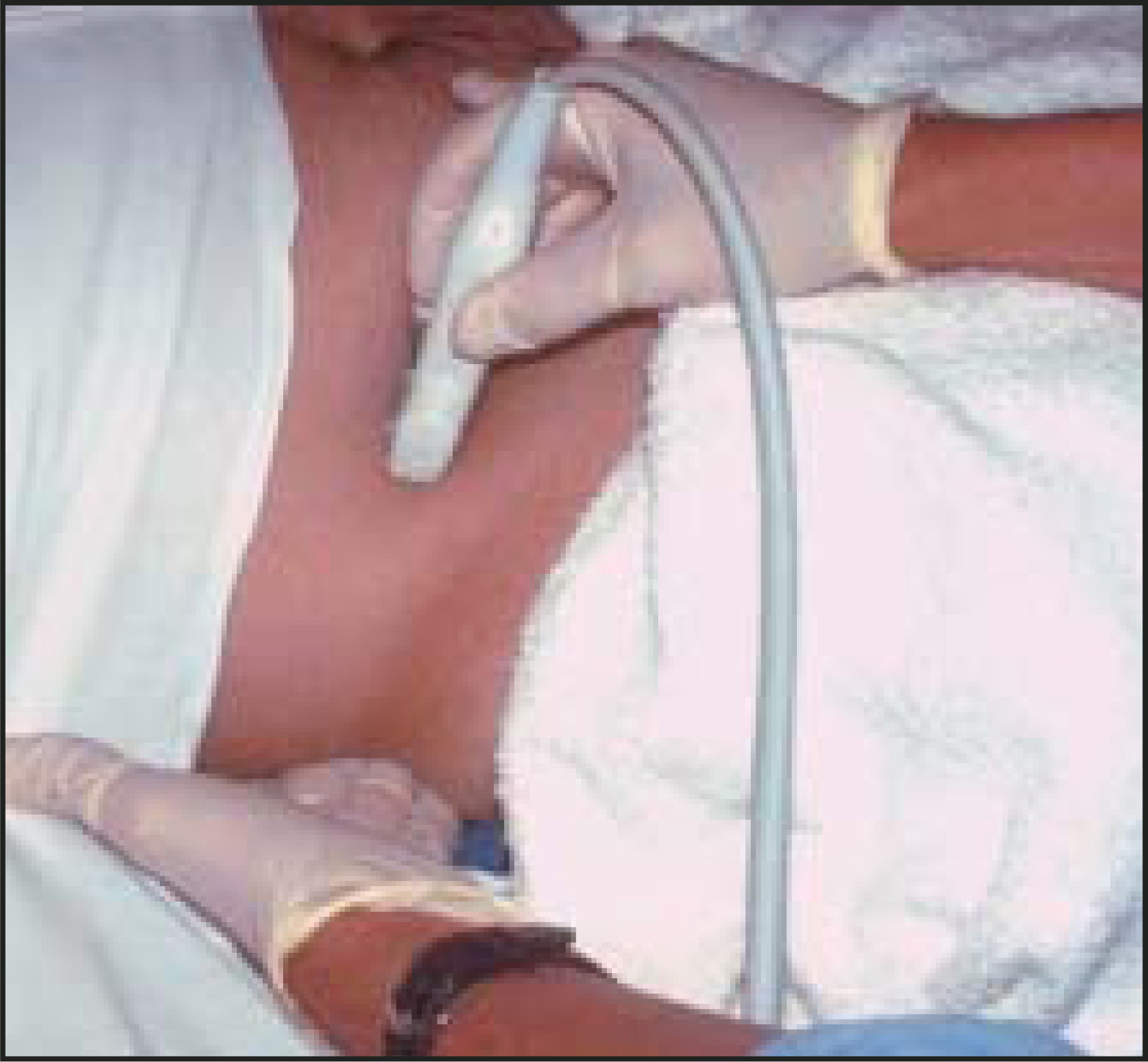 FIGURE 4.