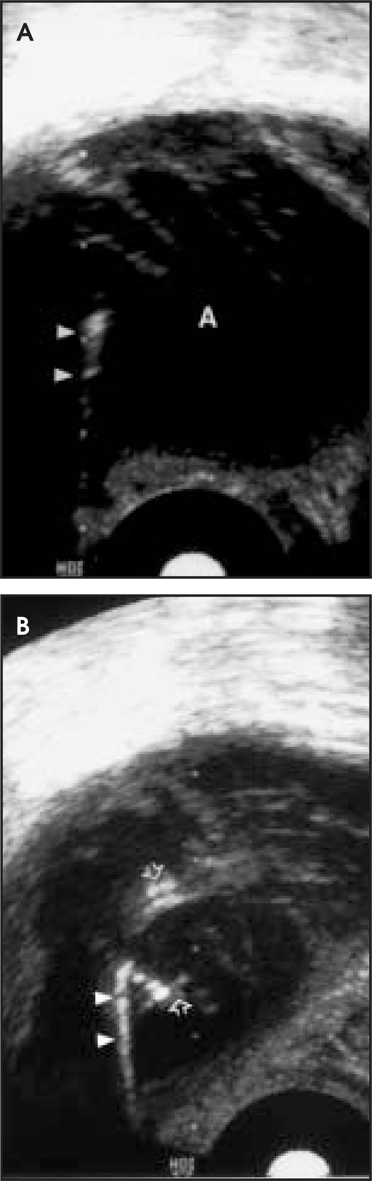 FIGURE 11.