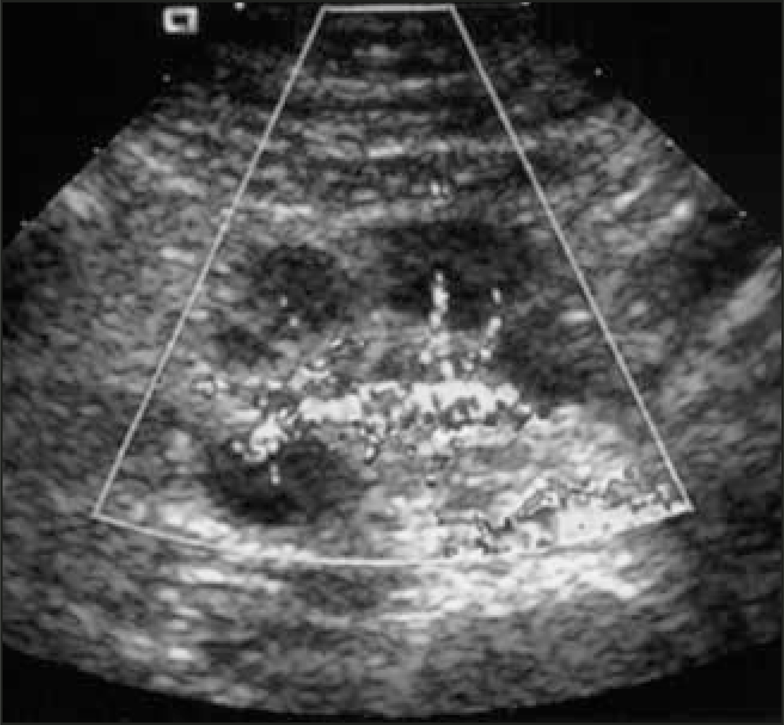 FIGURE 12.