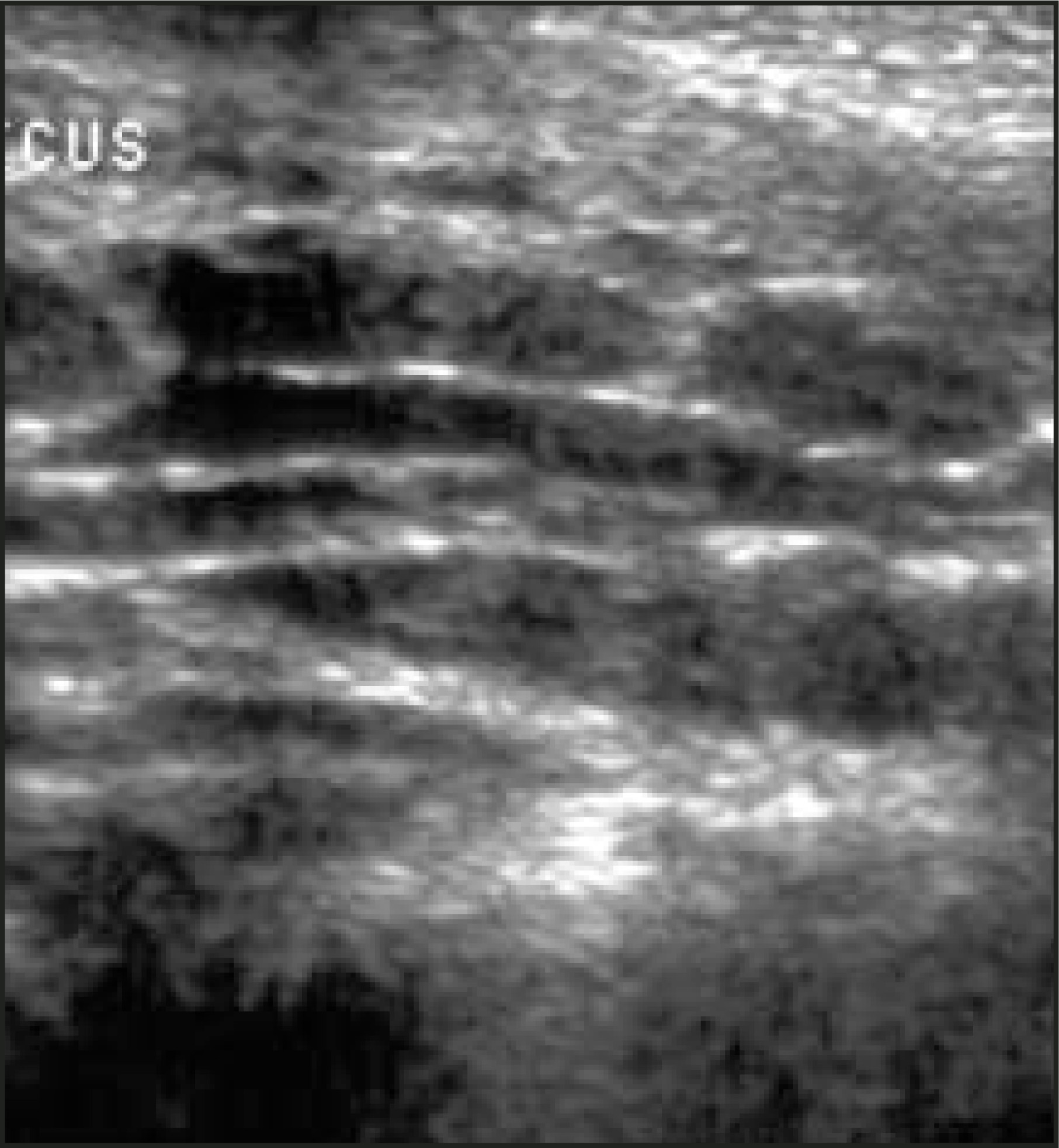 FIGURE 11.