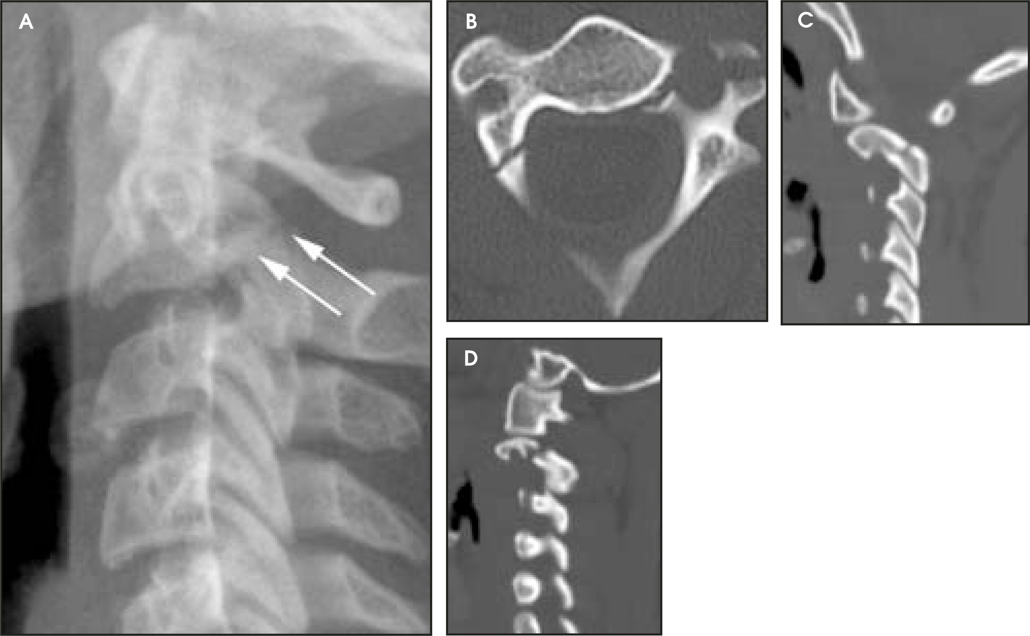 FIGURE 3.