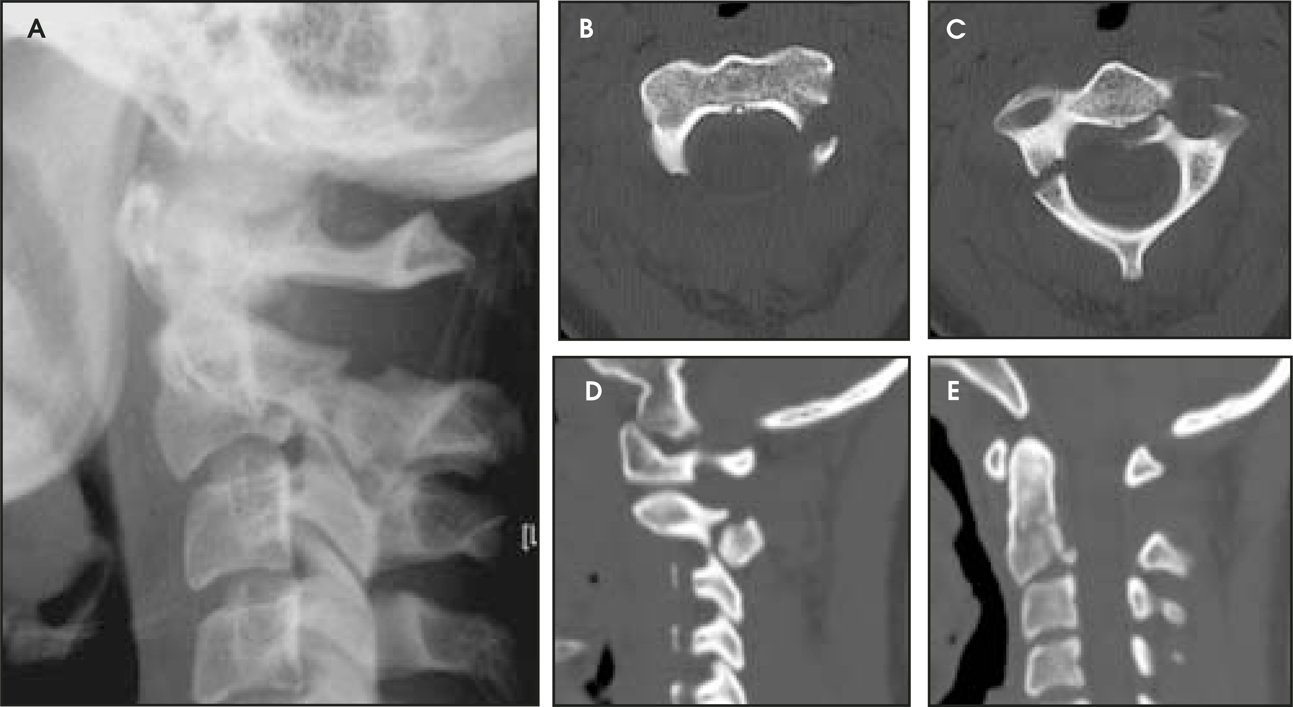 FIGURE 4.
