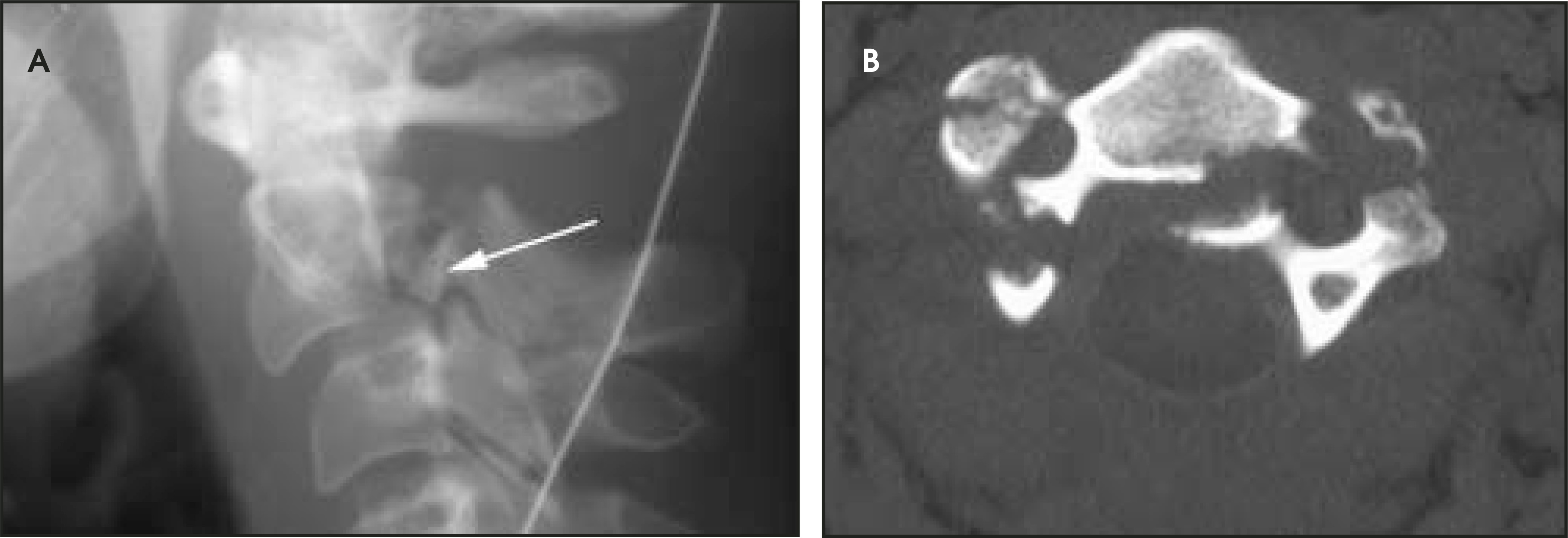 FIGURE 11.