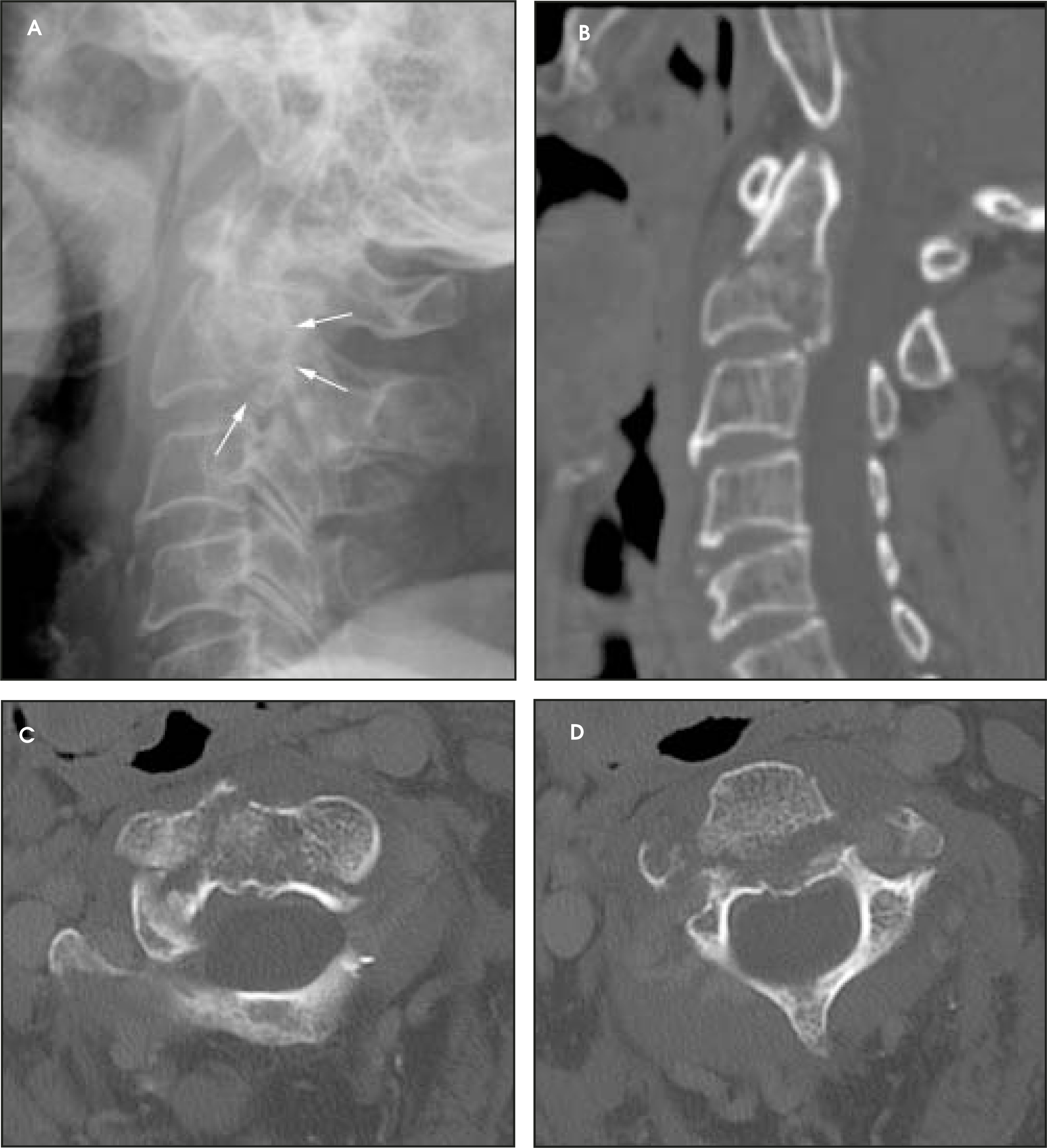FIGURE 13.