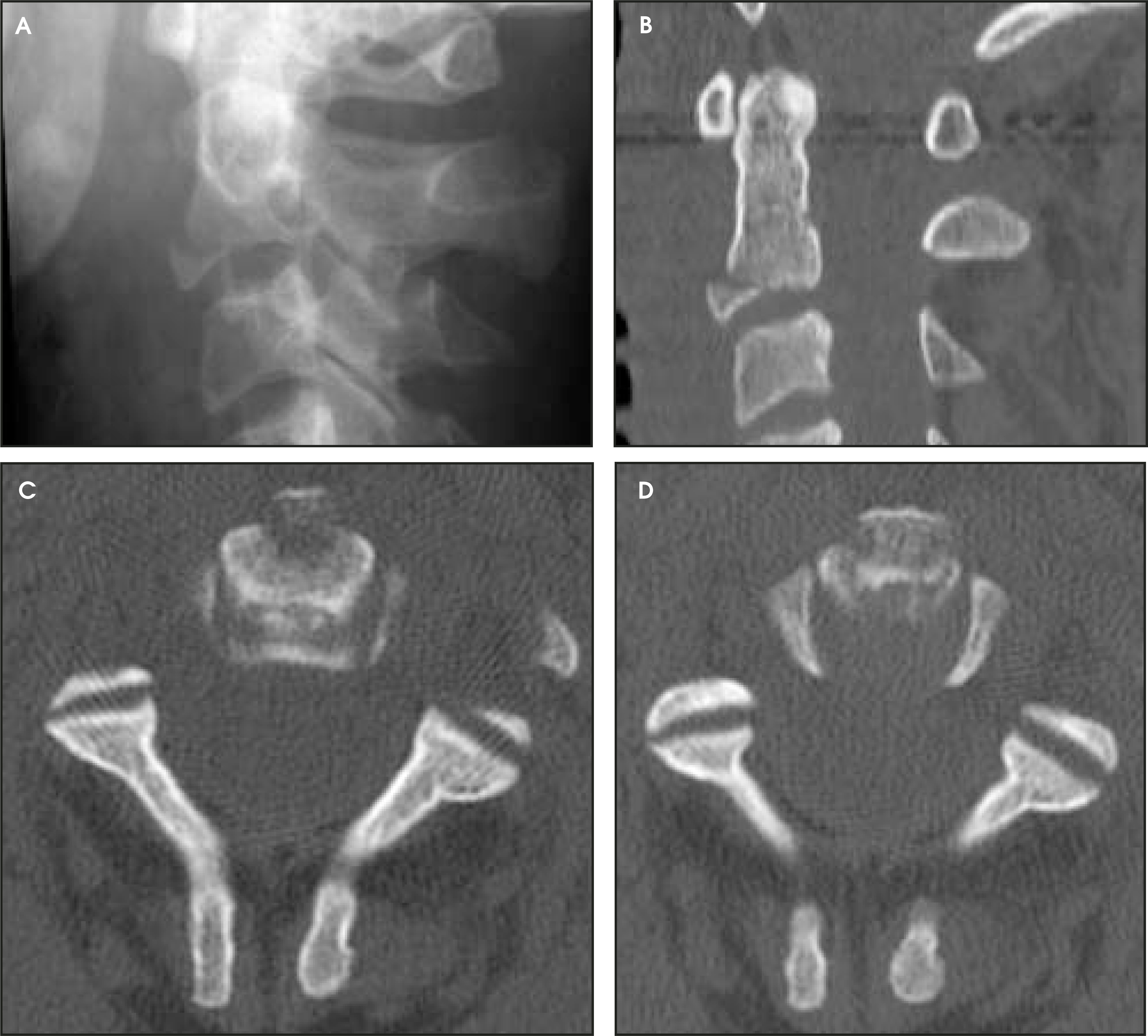 FIGURE 14.