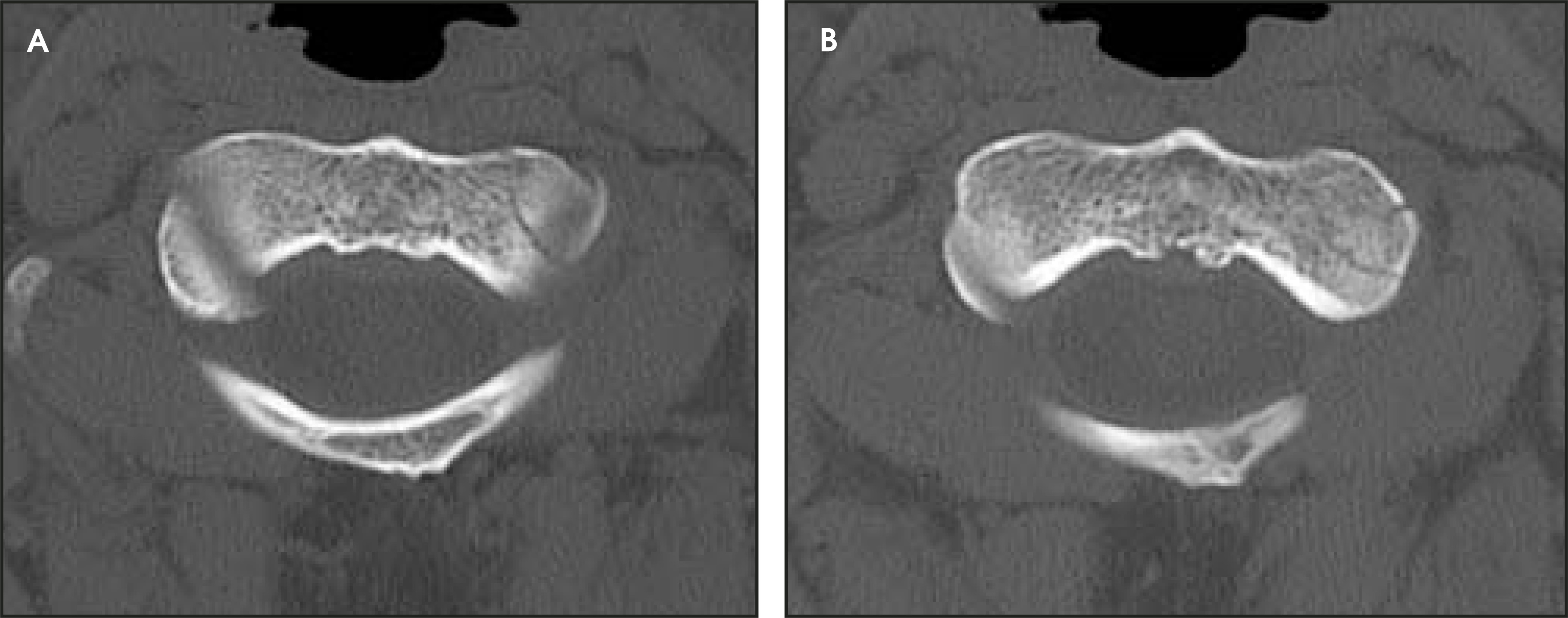 FIGURE 17.