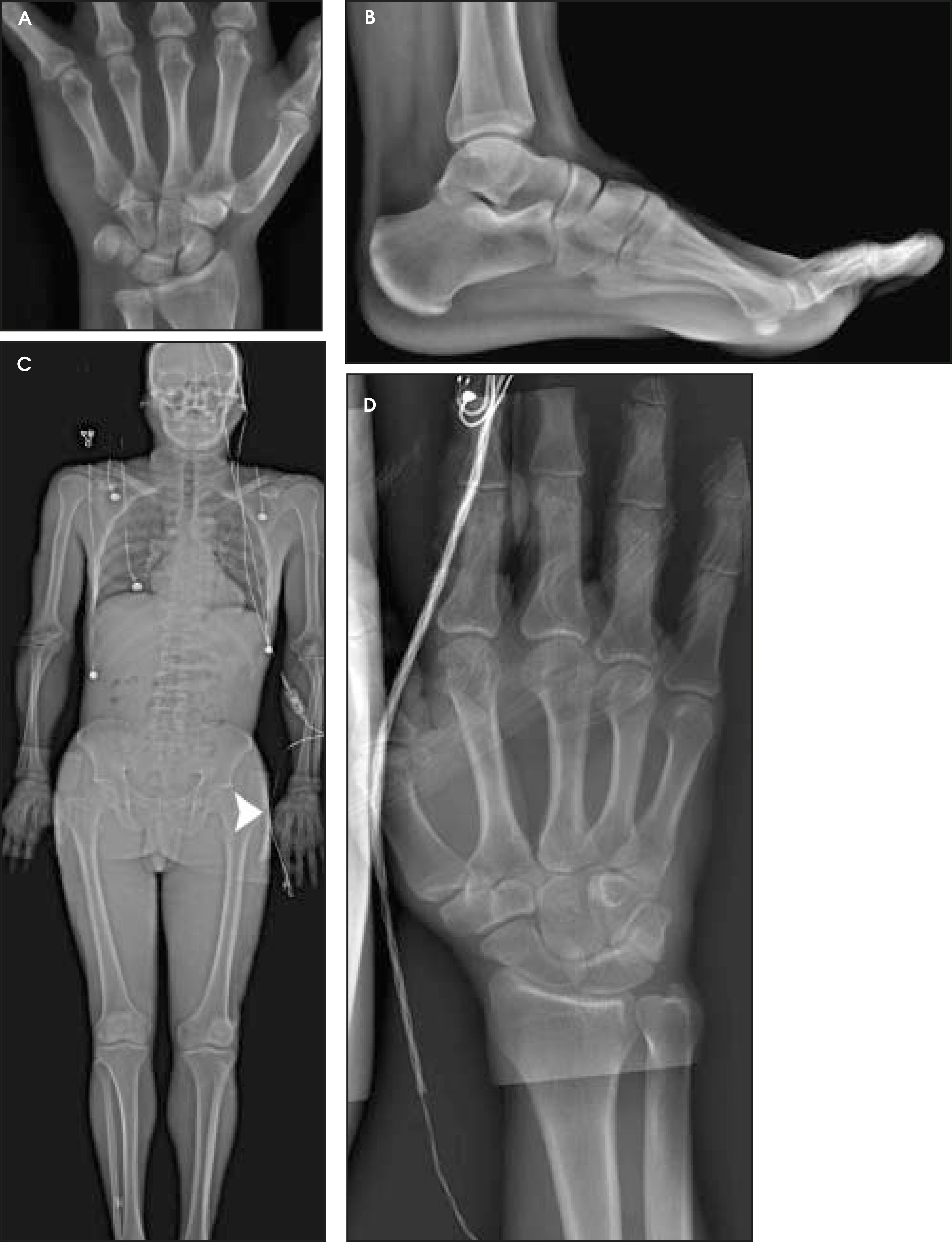 FIGURE 3.