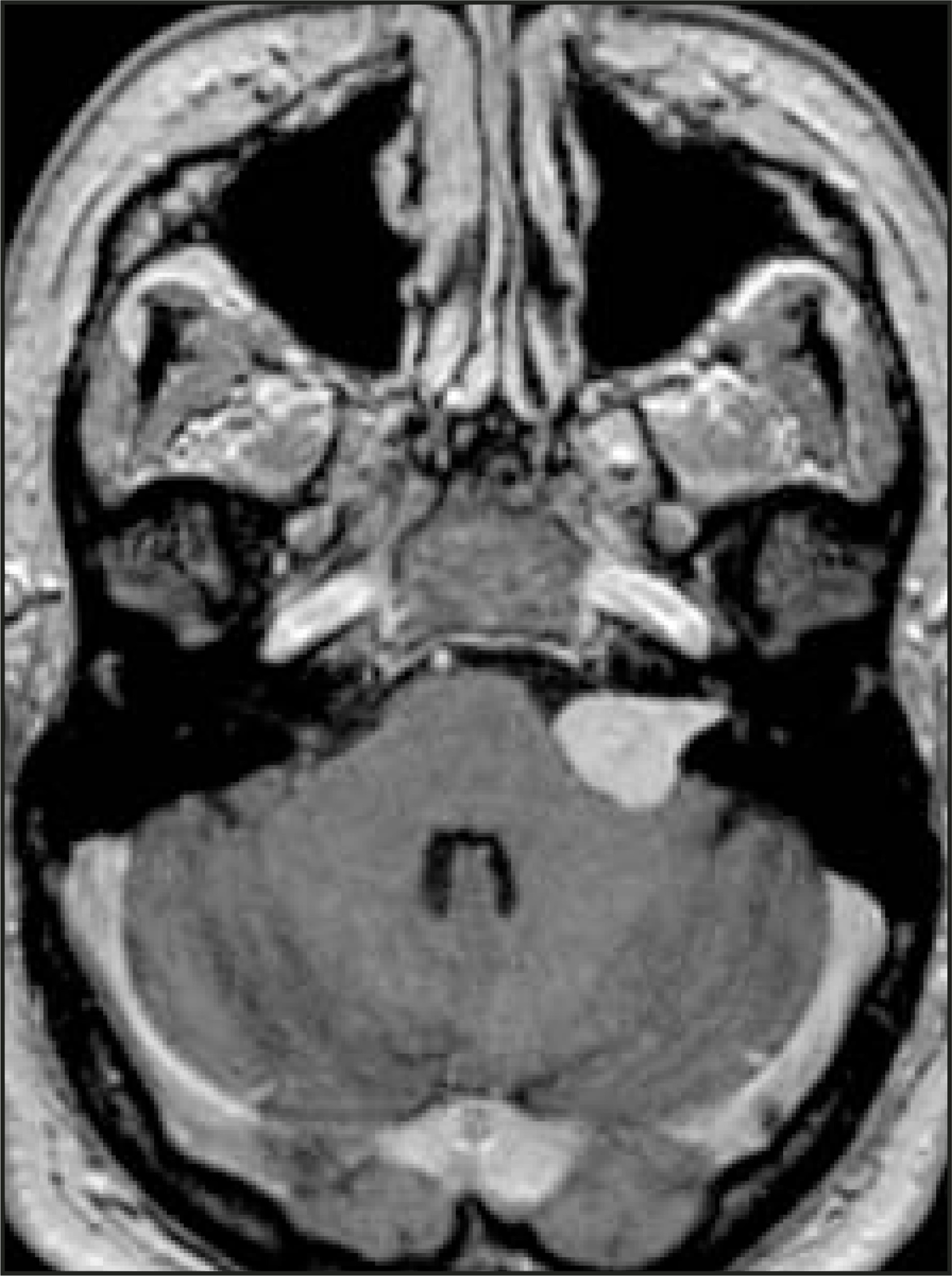 FIGURE 11.