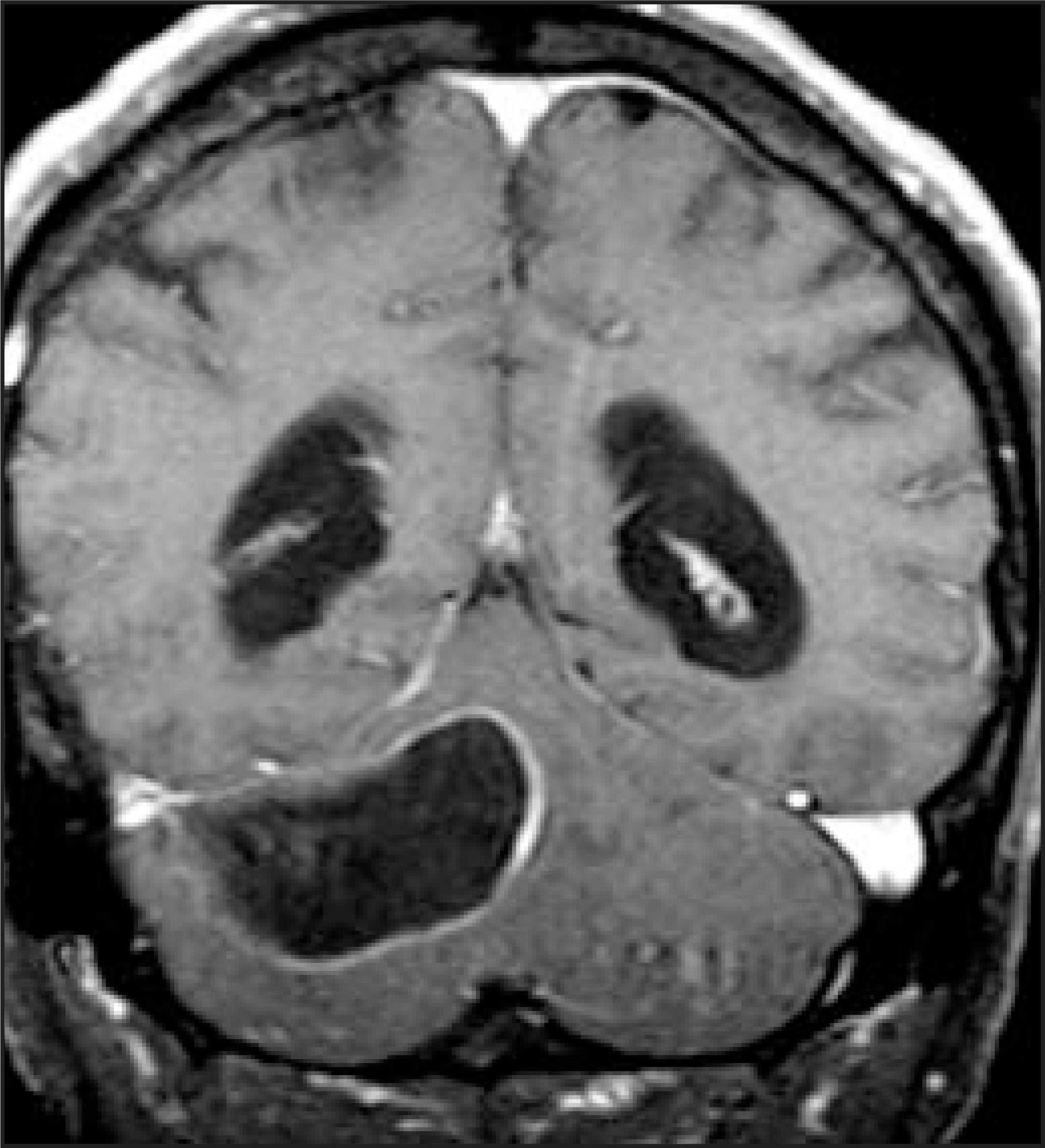 FIGURE 13.