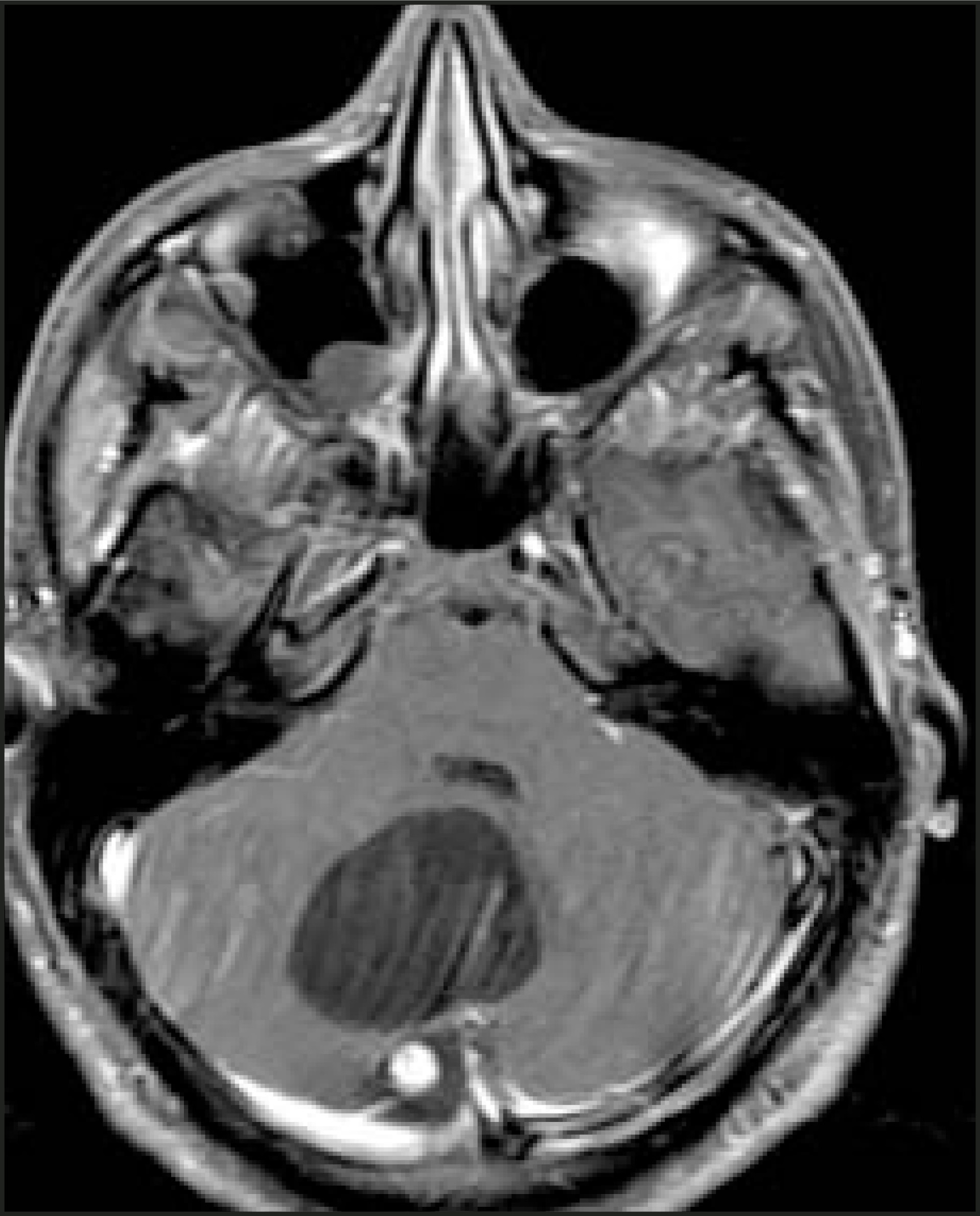 FIGURE 14.