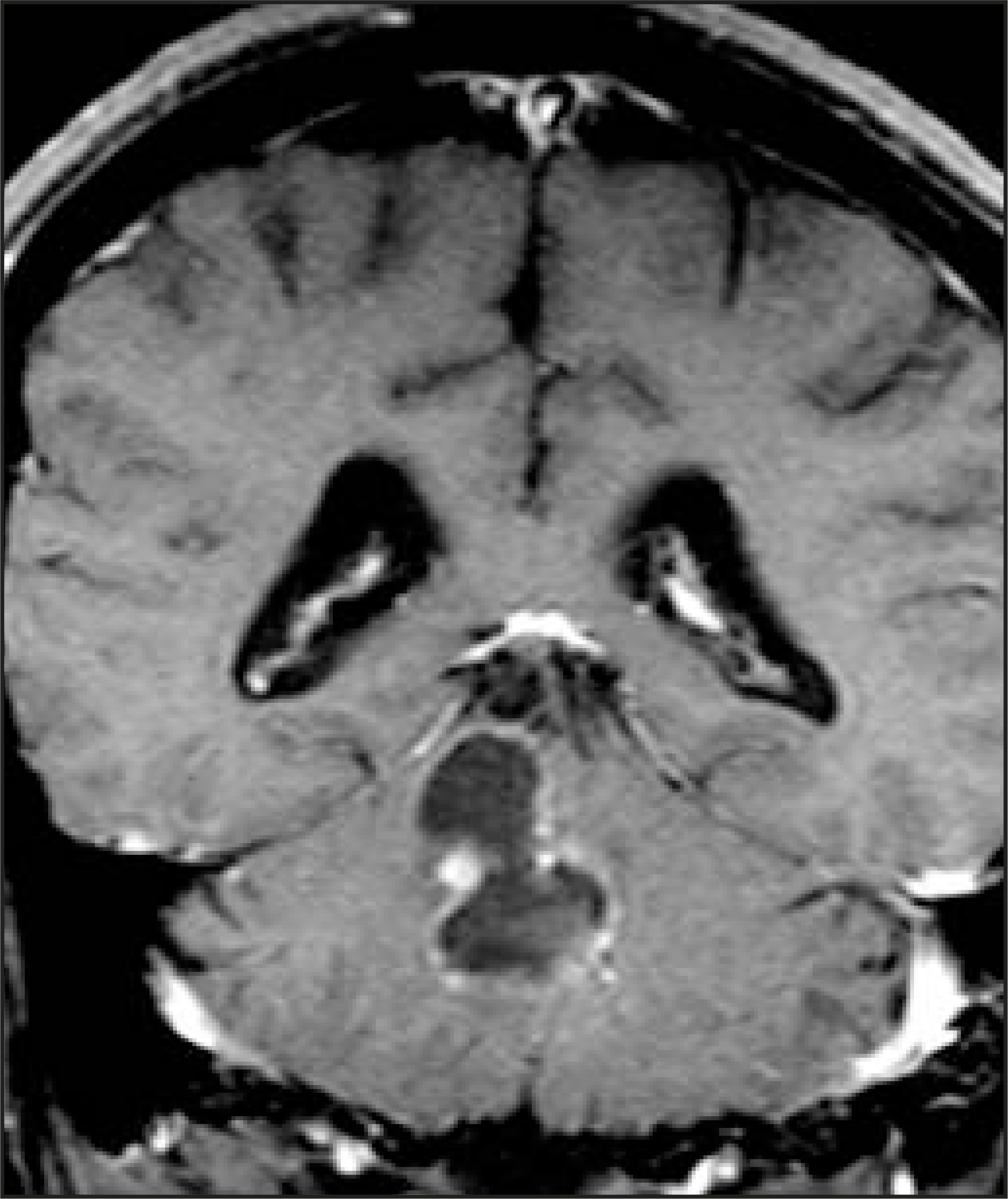 FIGURE 15.