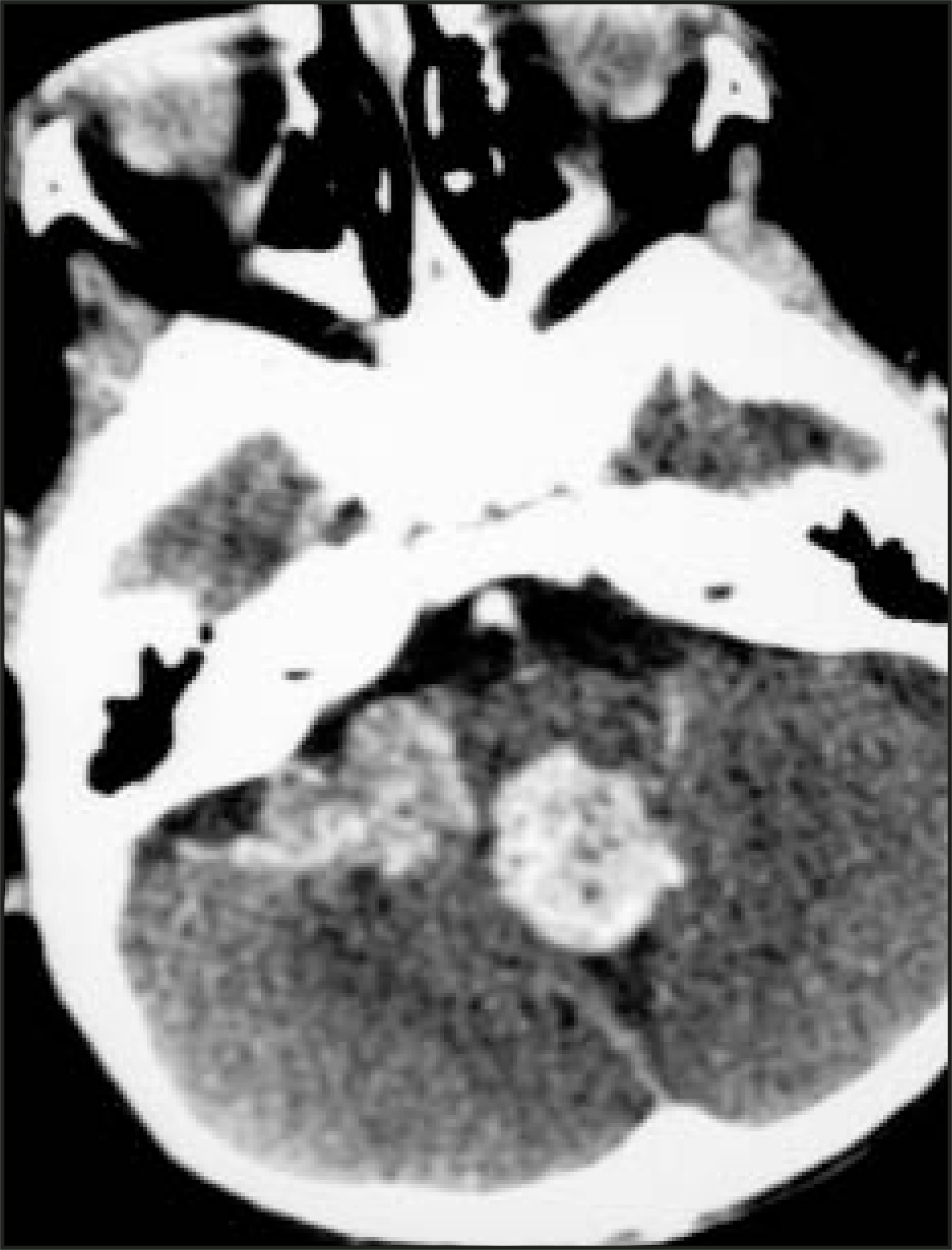 FIGURE 16.